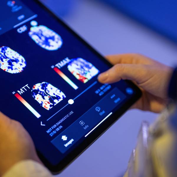 Eine Radiologin im Unfallkrankenhaus Berlin betrachtet in einer KI-basierten App auf einem Tablet Gehirnbilder eines Patienten.