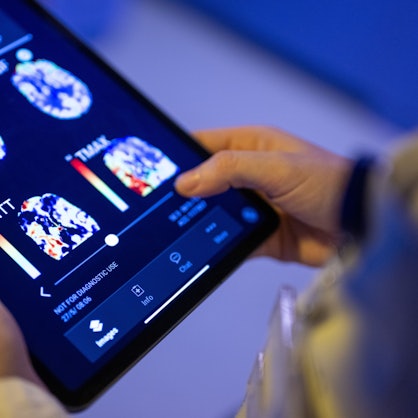 Eine Radiologin im Unfallkrankenhaus Berlin betrachtet in einer KI-basierten App auf einem Tablet Gehirnbilder eines Patienten.