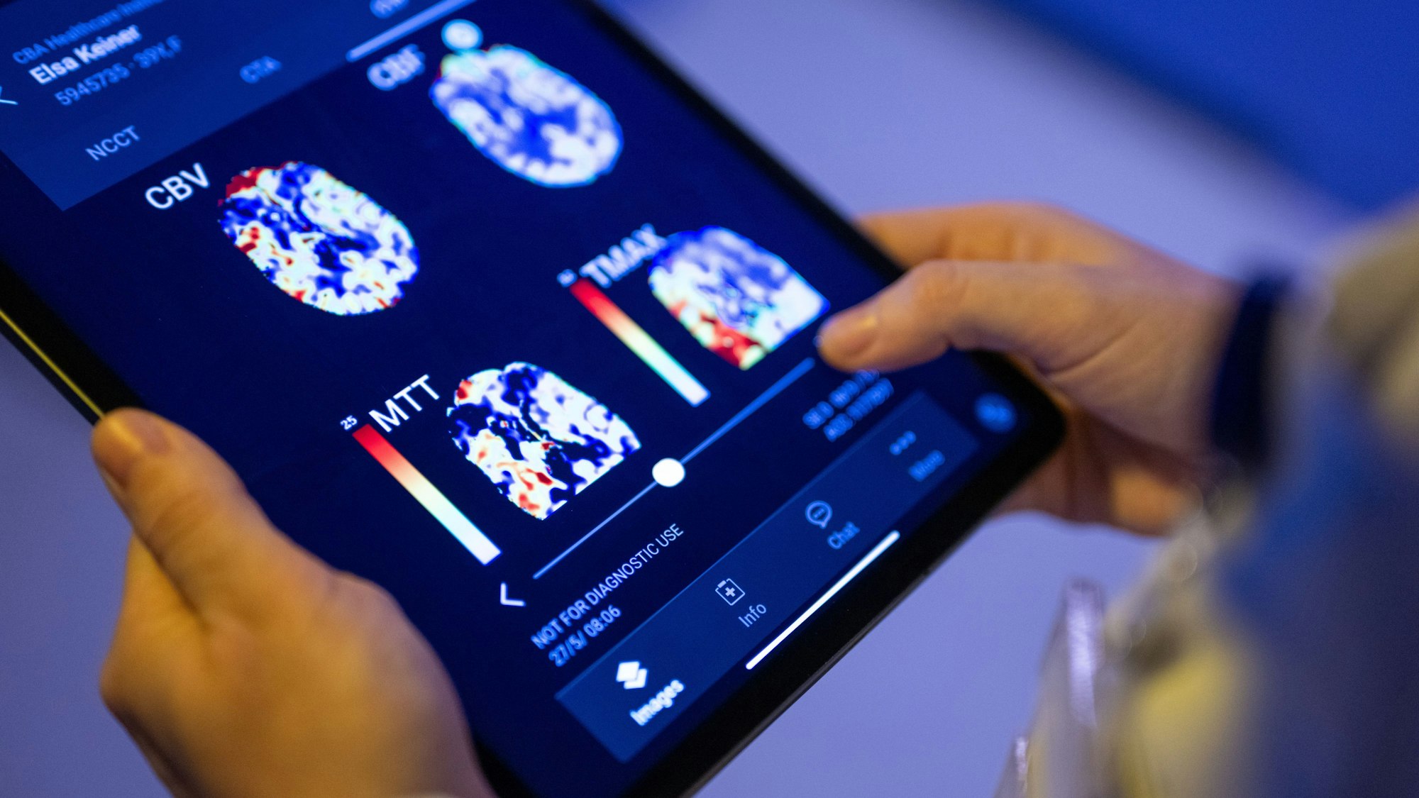 Eine Radiologin im Unfallkrankenhaus Berlin betrachtet in einer KI-basierten App auf einem Tablet Gehirnbilder eines Patienten.