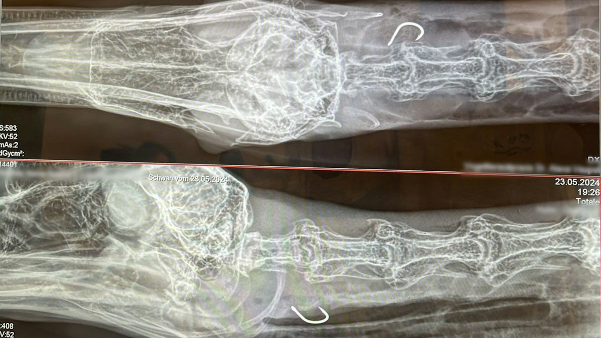 Röntgenaufnahmen von Schwan