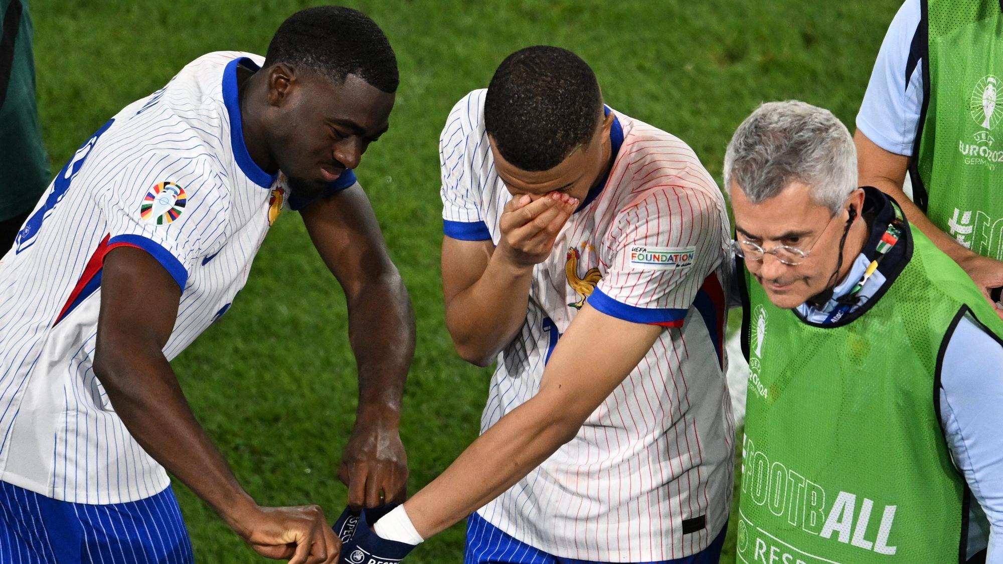 Frankreichs Superstar Kylian Mbappé (M) hält sich bei seiner Auswechslung die blutige Nase und bekommt Hilfe von Teamkollege Youssouf Fofana.