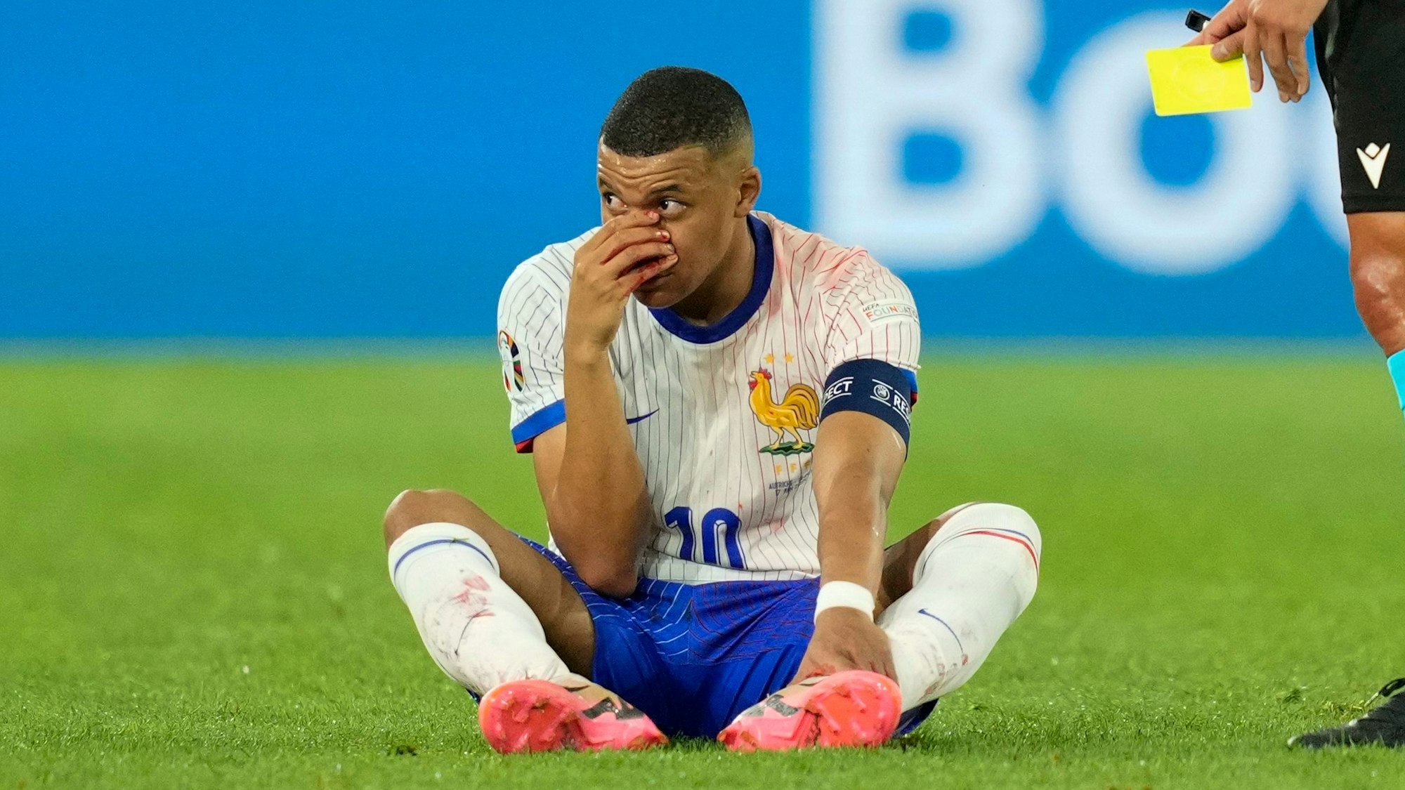 Kylian Mbappé legte sich nach seiner Rückkehr auf den Platz direkt auf den Rasen und sah dafür die Gelbe Karte. Später stand fest: Der Superstar hat sich die Nase gebrochen.