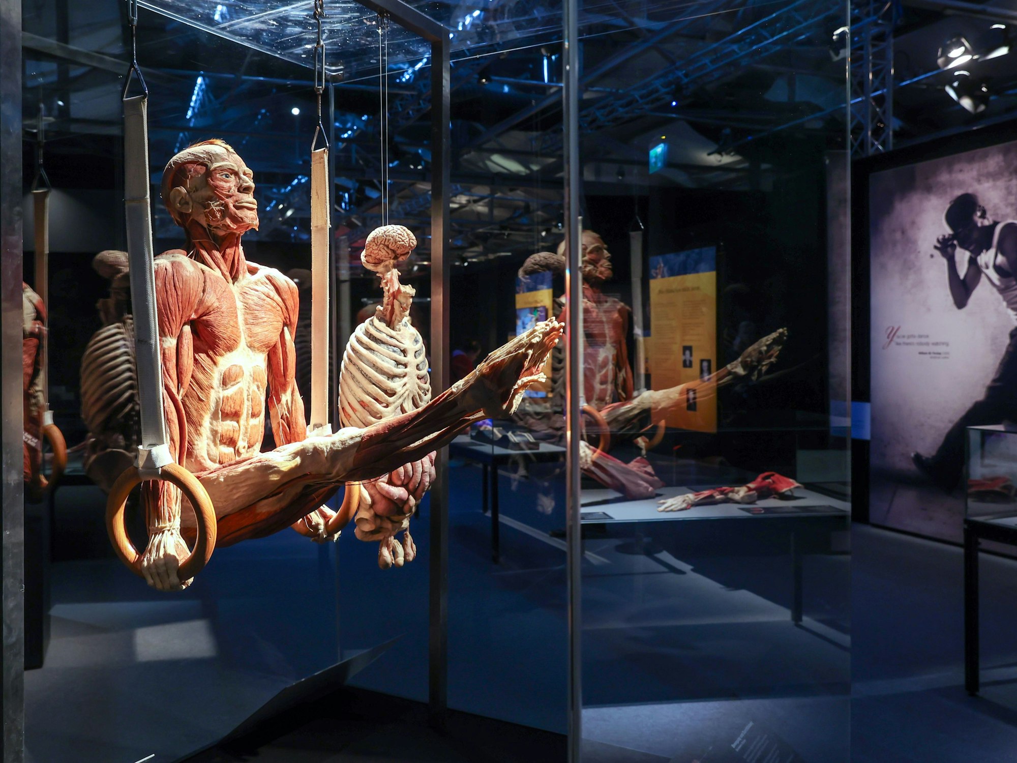 Zu sehen ist ein plastinierter Körper, der an Ringen turnt, hinter einer Glasvitrine.