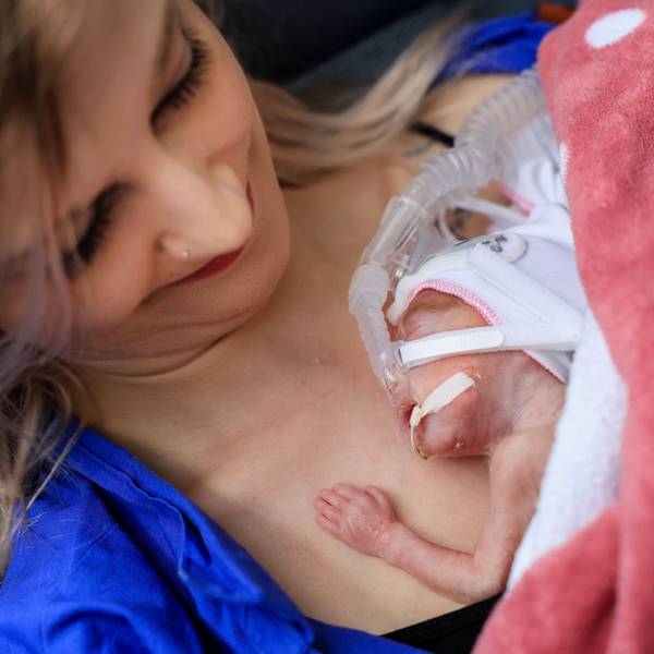 Ein Frühchen liegt auf der neonatologischen Intensivstation der Frauenklinik Köln auf der Brust ihrer Mutter Vanessa Janssen.