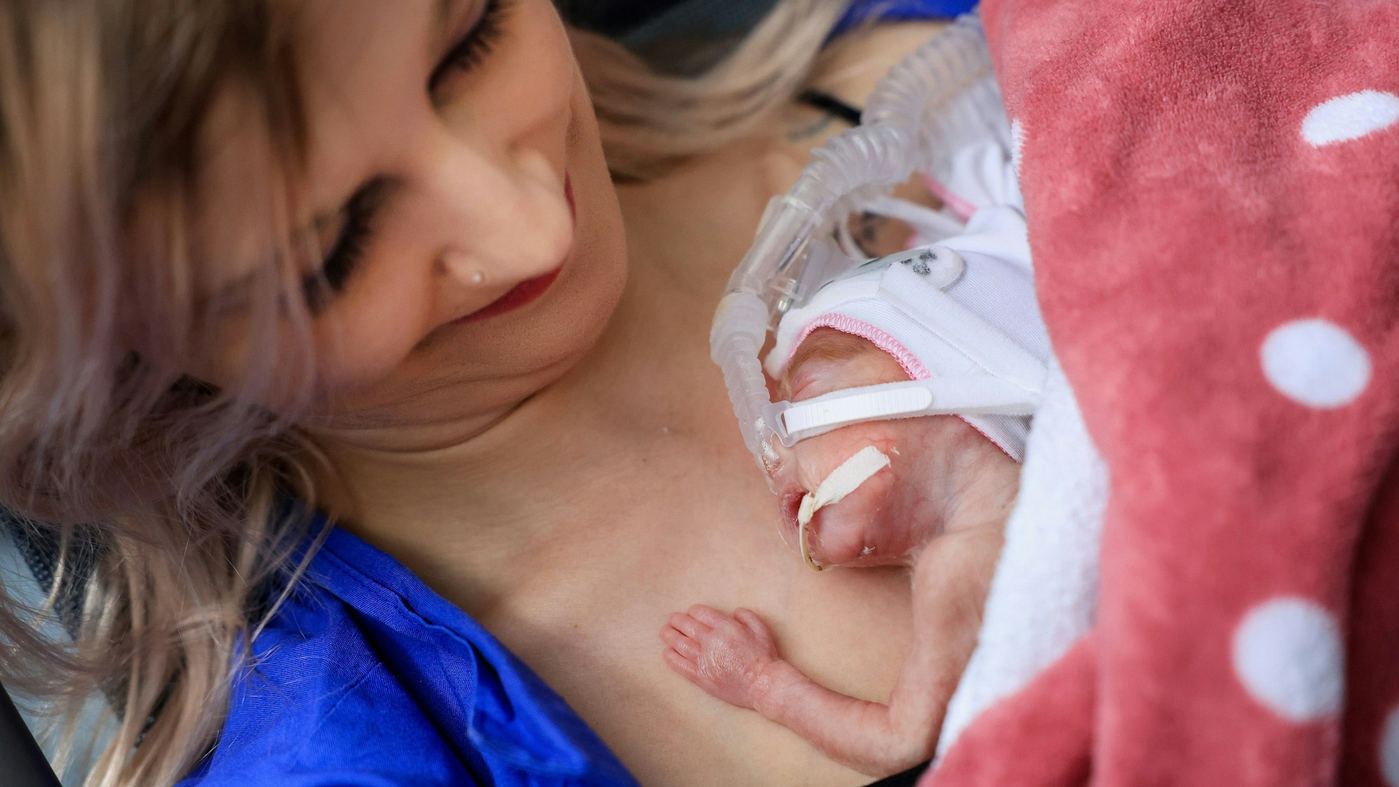 Ein Frühchen liegt auf der neonatologischen Intensivstation der Frauenklinik Köln auf der Brust ihrer Mutter Vanessa Janssen.