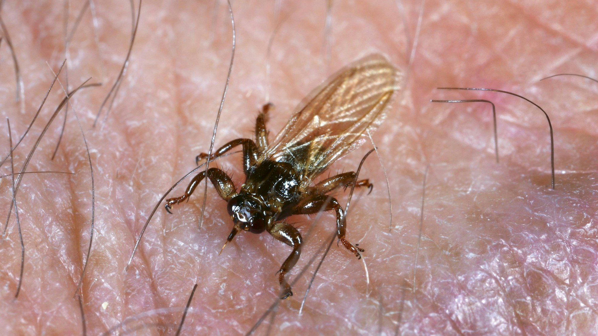 Eine Hirschlausfliege bei einem Stich in menschliche Haut.