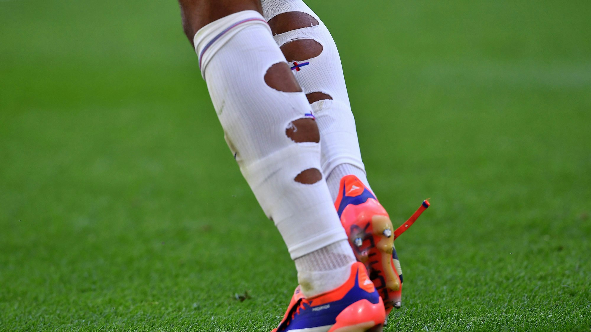 Auffällig bei der EM in Deutschland: Manche Stars, wie etwa Englands Jude Bellingham, spielen mit aufgerissenen Stutzen.