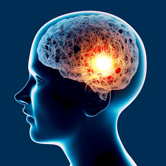 3-D-Darstellung eines Gehirns