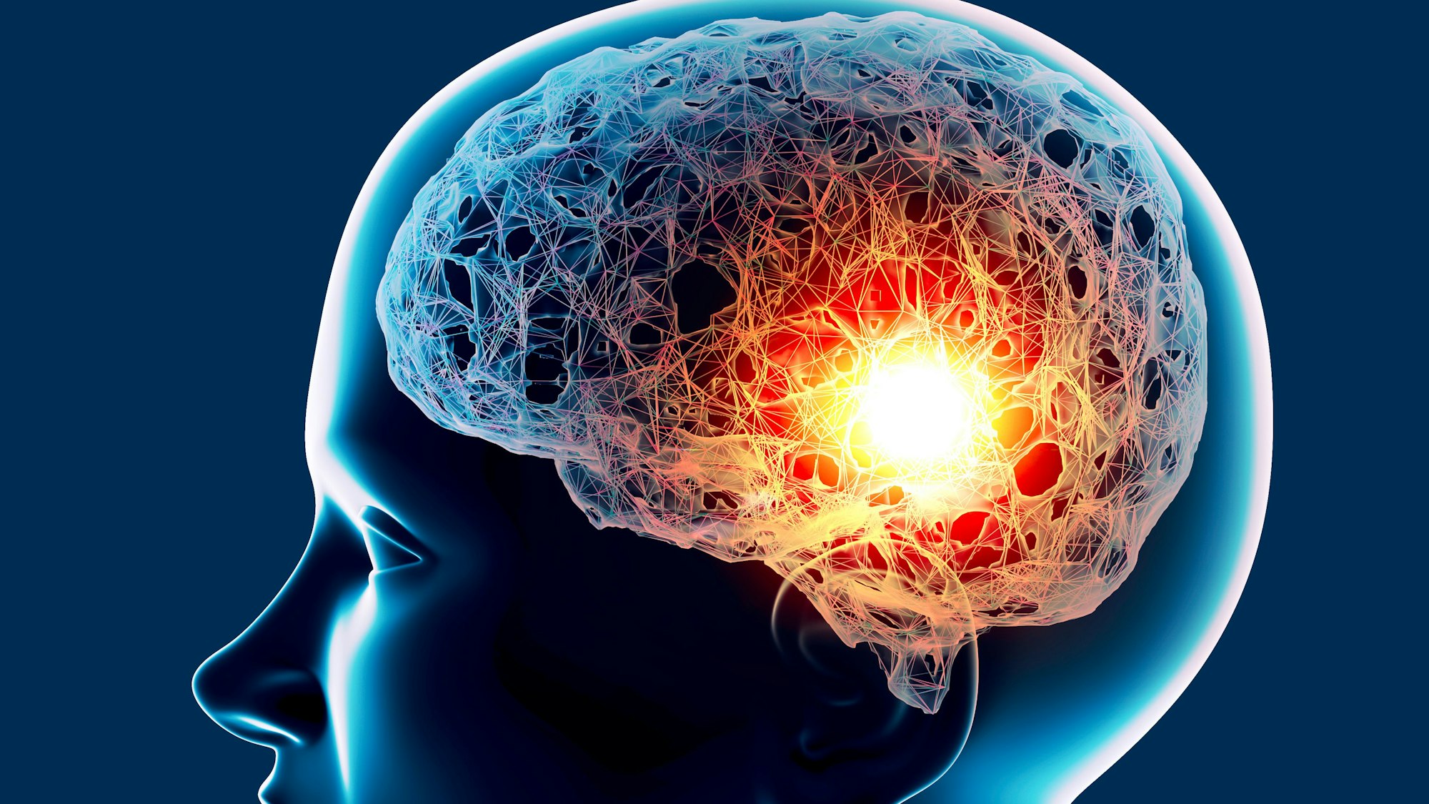 3-D-Darstellung eines Gehirns