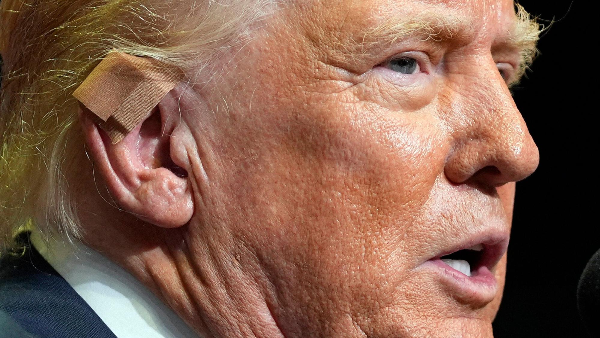 Noch immer ist der republikanische Präsidentschaftskandidat und ehemalige US-Präsident Donald Trump von den Schüssen auf ihn gezeichnet.