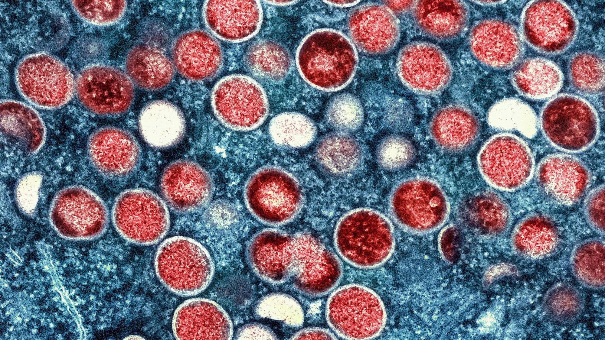 Eine eingefärbte Mikroskopaufnahme von Mpox-Partikeln (rot) in einer infizierten Zelle (blau), die im Labor kultiviert wurde. (Symbolbild)