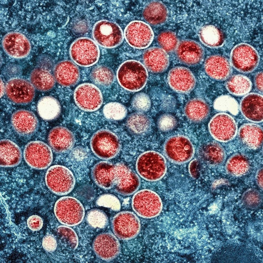 Das Bild zeigt eine kolorierte Transmissionselektronenmikroaufnahme von Affenpockenpartikeln (rot) in einer infizierten Zelle (blau), die im Labor kultiviert wurde.