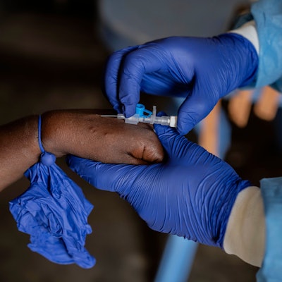 Ein Mitarbeiter des Gesundheitswesens kümmert sich um einen Mpox-Patienten in einem Behandlungszentrum im Kongo.