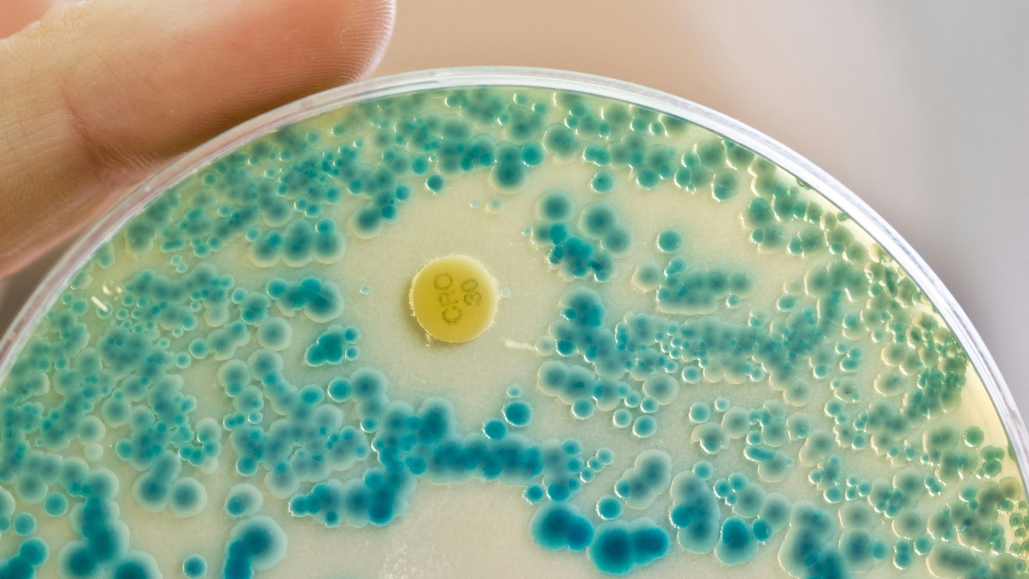 ARCHIV - 21.07.2015, Bayern, Erlangen: ILLUSTRATION - Eine Labormitarbeiterin an einem Institut für Klinische Mikrobiologie, Immunologie und Hygiene hält im Diagnostiklabor eine Indikatorkulturplatte zum Nachweis von resistenten Bakterien in der Hand.