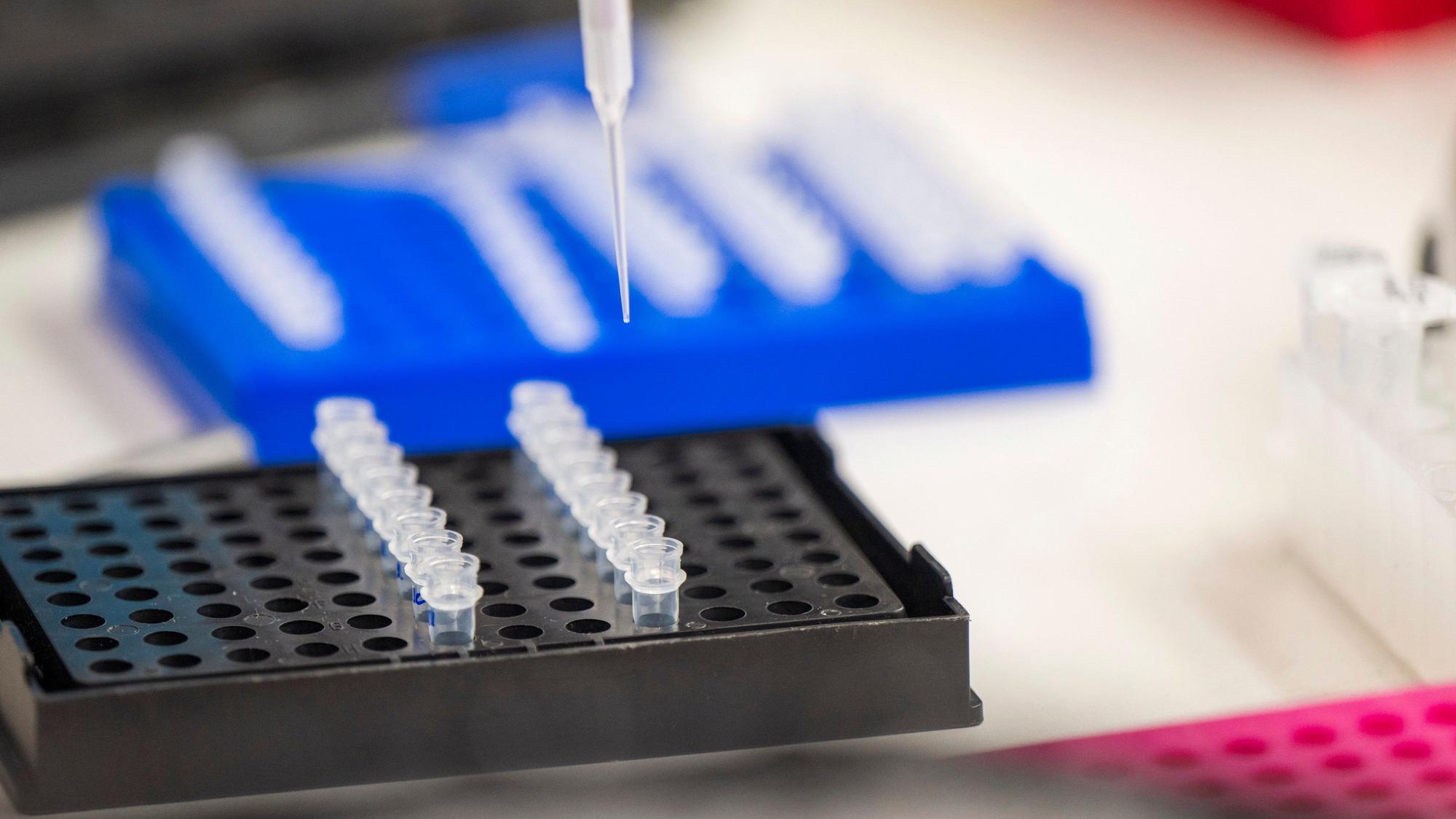 DNA-Proben in einem Labor. Ein Online-DNA-Test lieferte bei einem Vermisstenfall in den USA entscheidende Hinweise. (Symbolbild)