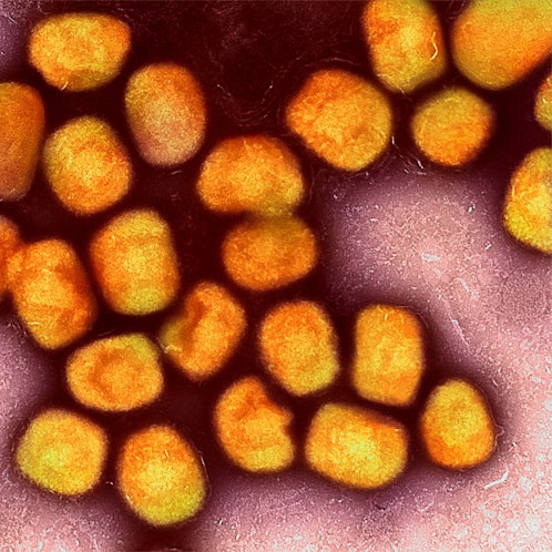 Eine kolorierte transmissionselektronenmikroskopische Aufnahme von Partikeln des Affenpockenvirus (Gold), kultiviert und gereinigt aus einer Zellkultur, aufgenommen in der NIAID Integrated Research Facility, veröffentlicht am 26. Juli 2022, in Fort Detrick, Maryland.