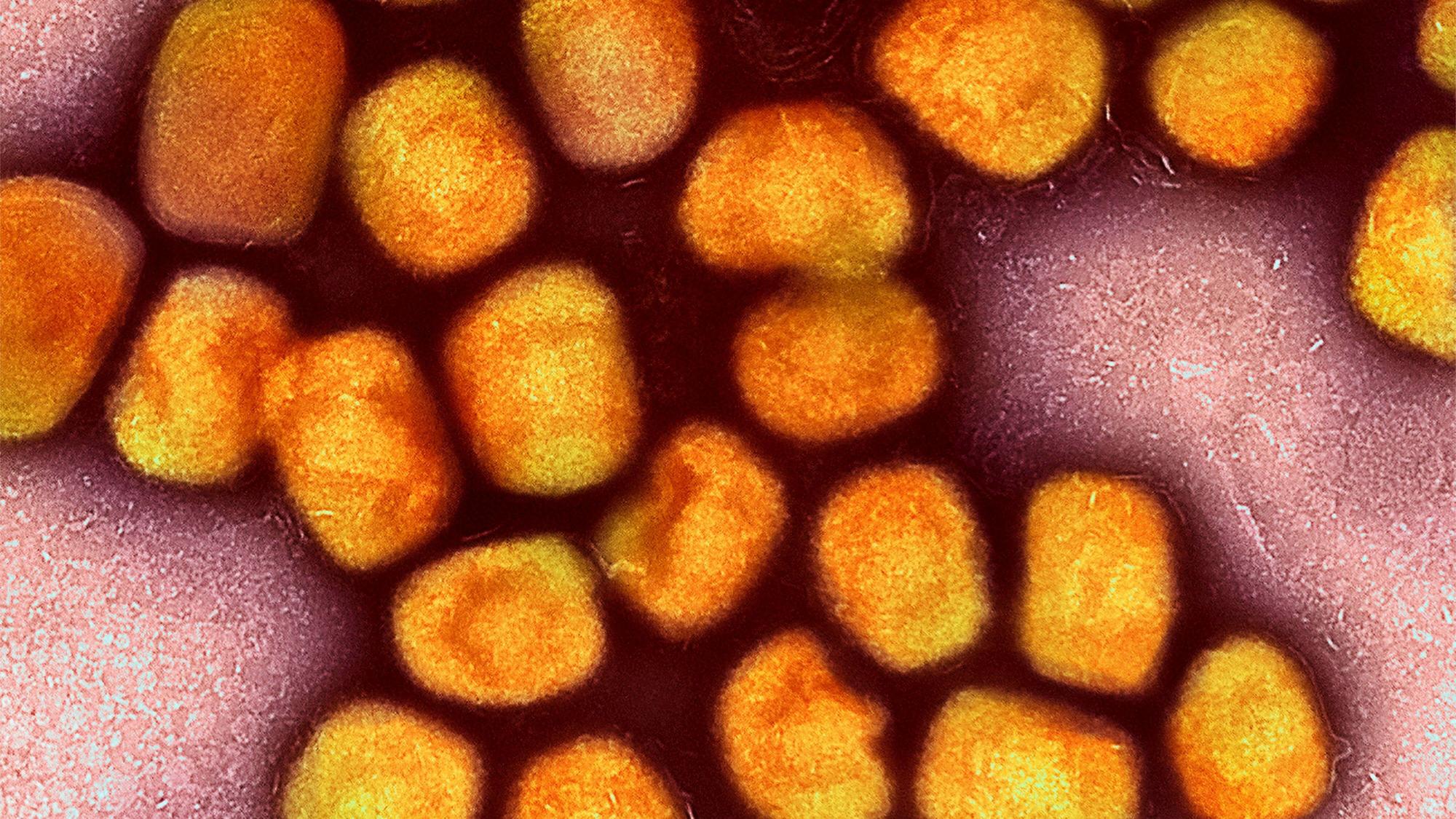 Eine kolorierte transmissionselektronenmikroskopische Aufnahme von Partikeln des Affenpockenvirus (Gold), kultiviert und gereinigt aus einer Zellkultur, aufgenommen in der NIAID Integrated Research Facility, veröffentlicht am 26. Juli 2022, in Fort Detrick, Maryland.