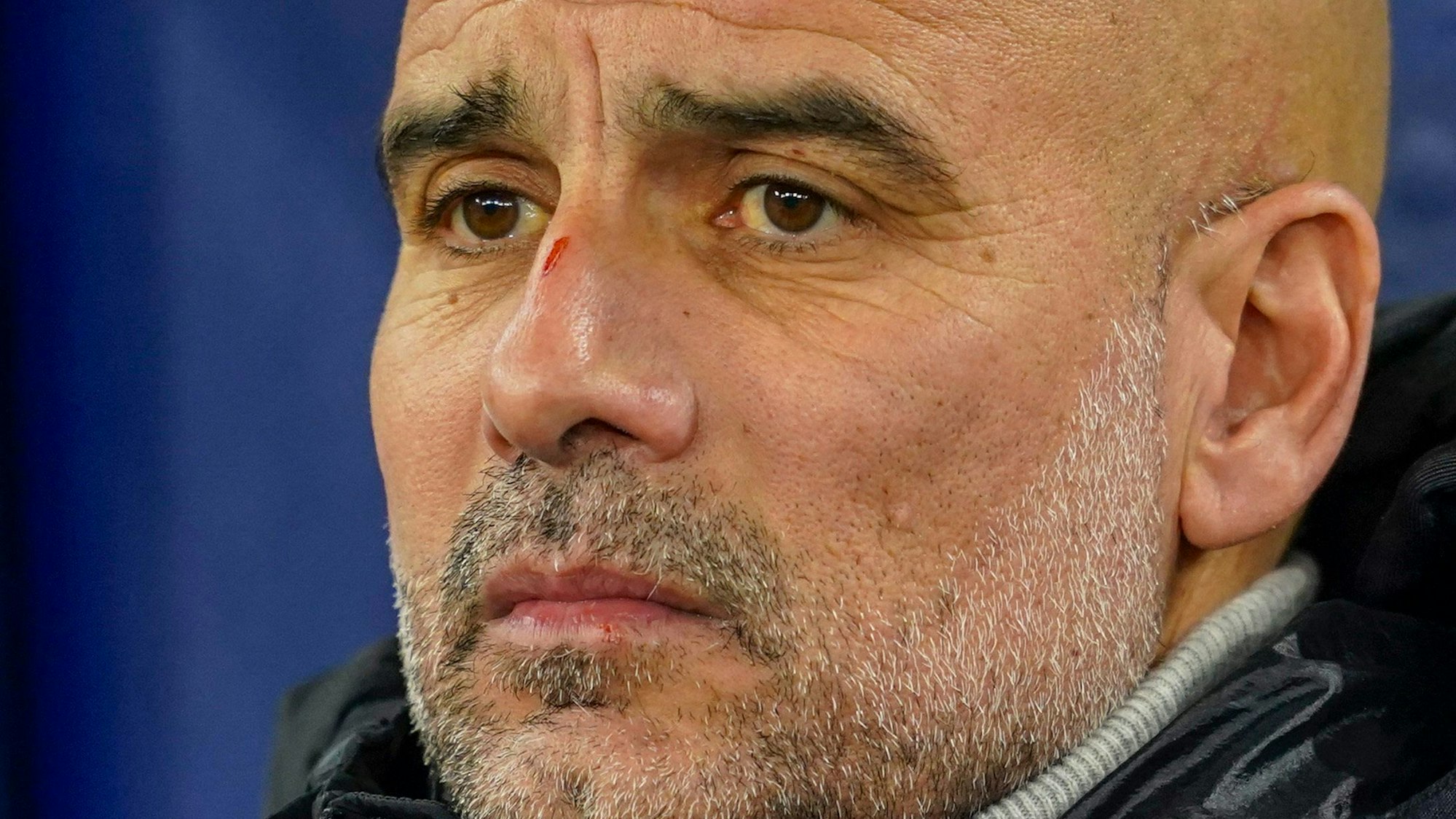 Die Krise von Manchester City und Trainer Pep Guardiola wird immer größer.