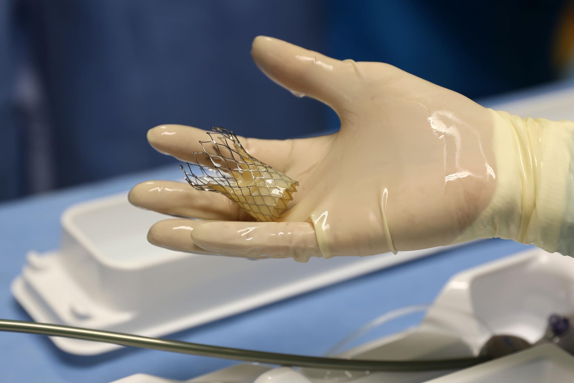 25.11.2024
Köln:
Herzzentrum an der Uniklinik Köln:
Minimalinvasive Herzklappen-OPs sind die große Chance für Ü-80-Patienten. Wir gucken live bei einer zu, die auch an eine Versammlung nach London übertragen wird.
Foto: Martina Goyert