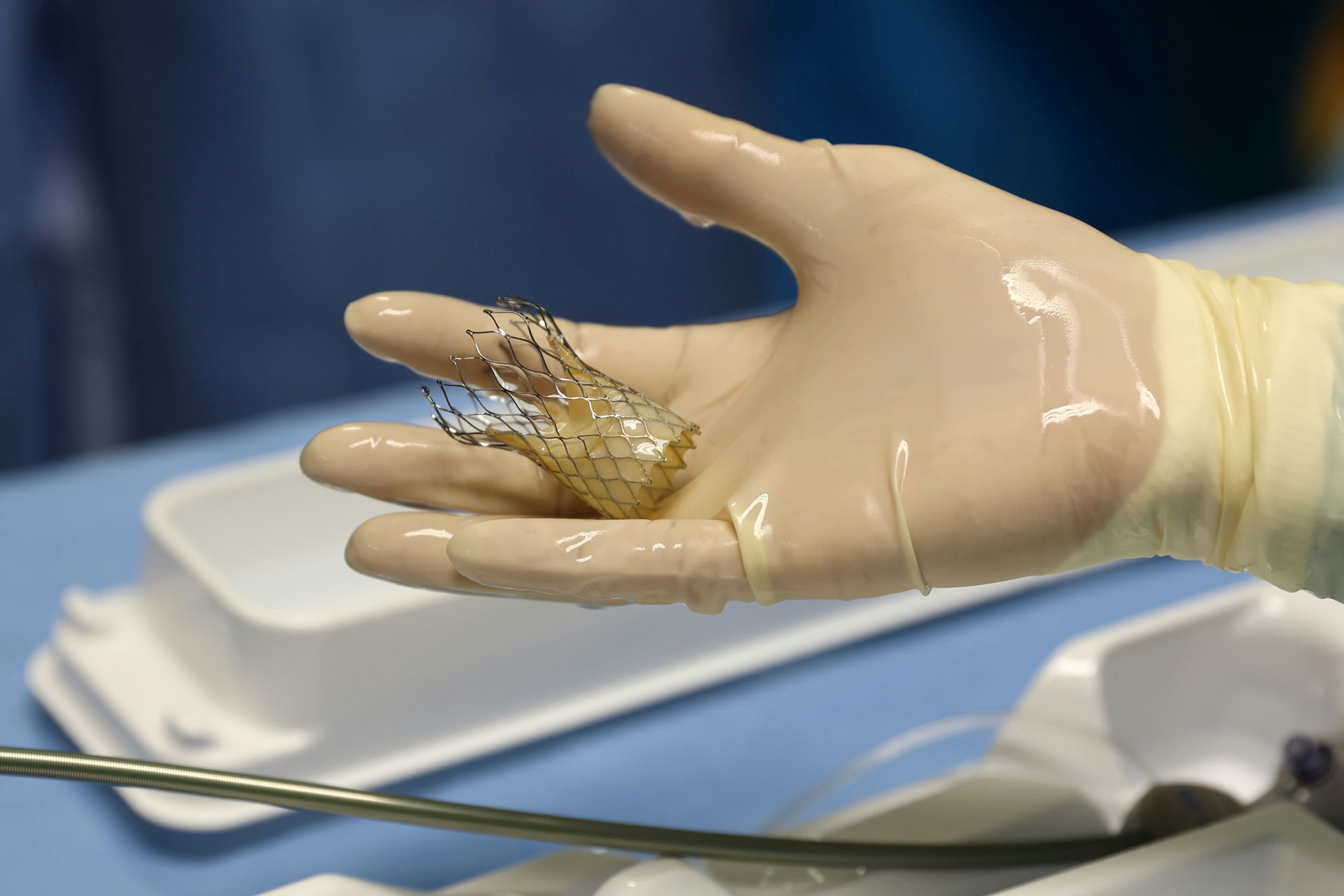 25.11.2024
Köln:
Herzzentrum an der Uniklinik Köln:
Minimalinvasive Herzklappen-OPs sind die große Chance für Ü-80-Patienten. Wir gucken live bei einer zu, die auch an eine Versammlung nach London übertragen wird.
Foto: Martina Goyert