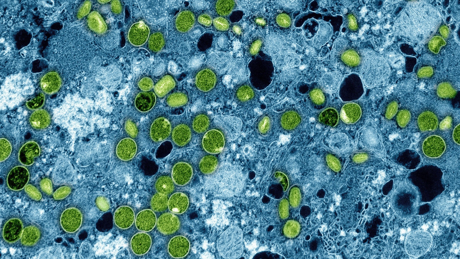 Diese kolorierte elektronenmikroskopische Aufnahme des National Institute of Allergy and Infectious Diseases aus dem Jahr 2024 zeigt Mpox-Viruspartikel (grün), die sich in infizierten kultivierten Zellen (blau) befinden. Die Viruspartikel befinden sich in verschiedenen Reifestadien, was zu Unterschieden in der Form führt.