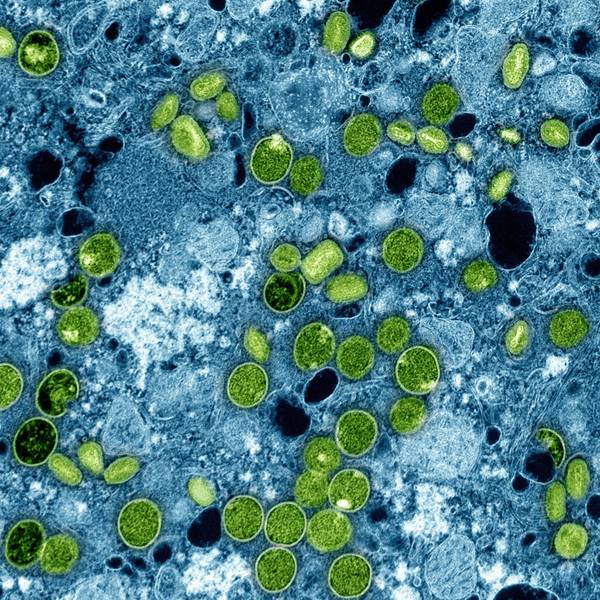 Diese kolorierte elektronenmikroskopische Aufnahme des National Institute of Allergy and Infectious Diseases aus dem Jahr 2024 zeigt Mpox-Viruspartikel (grün), die sich in infizierten kultivierten Zellen (blau) befinden. Die Viruspartikel befinden sich in verschiedenen Reifestadien, was zu Unterschieden in der Form führt.