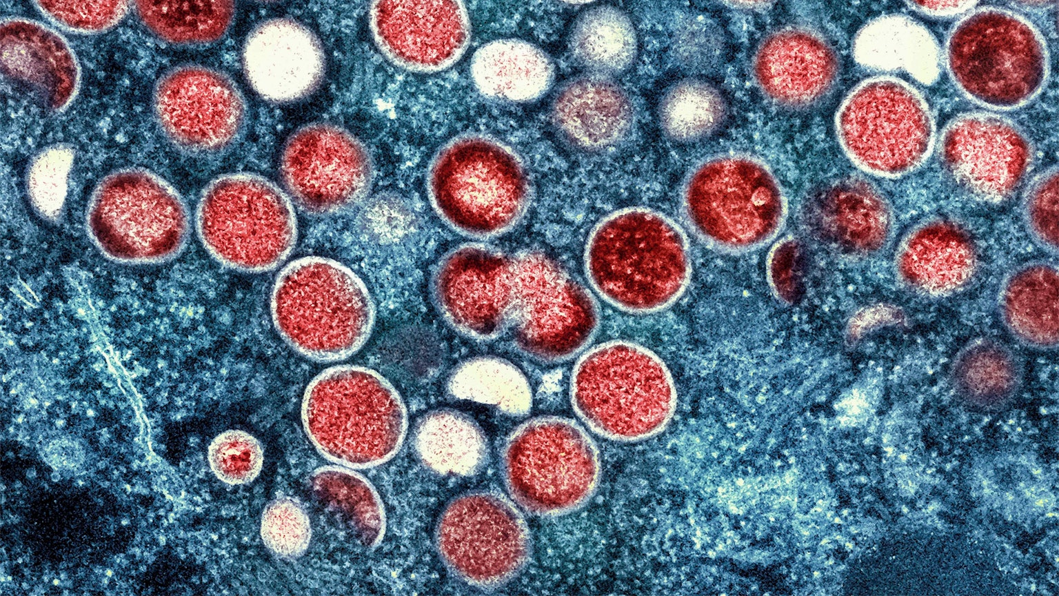 Eine kolorierte transmissionselektronenmikroskopische Aufnahme von Partikeln des Virus in einer infizierten Zelle, die im Labor gezüchtet und in der NIAID Integrated Research Facility aufgenommen wurde.