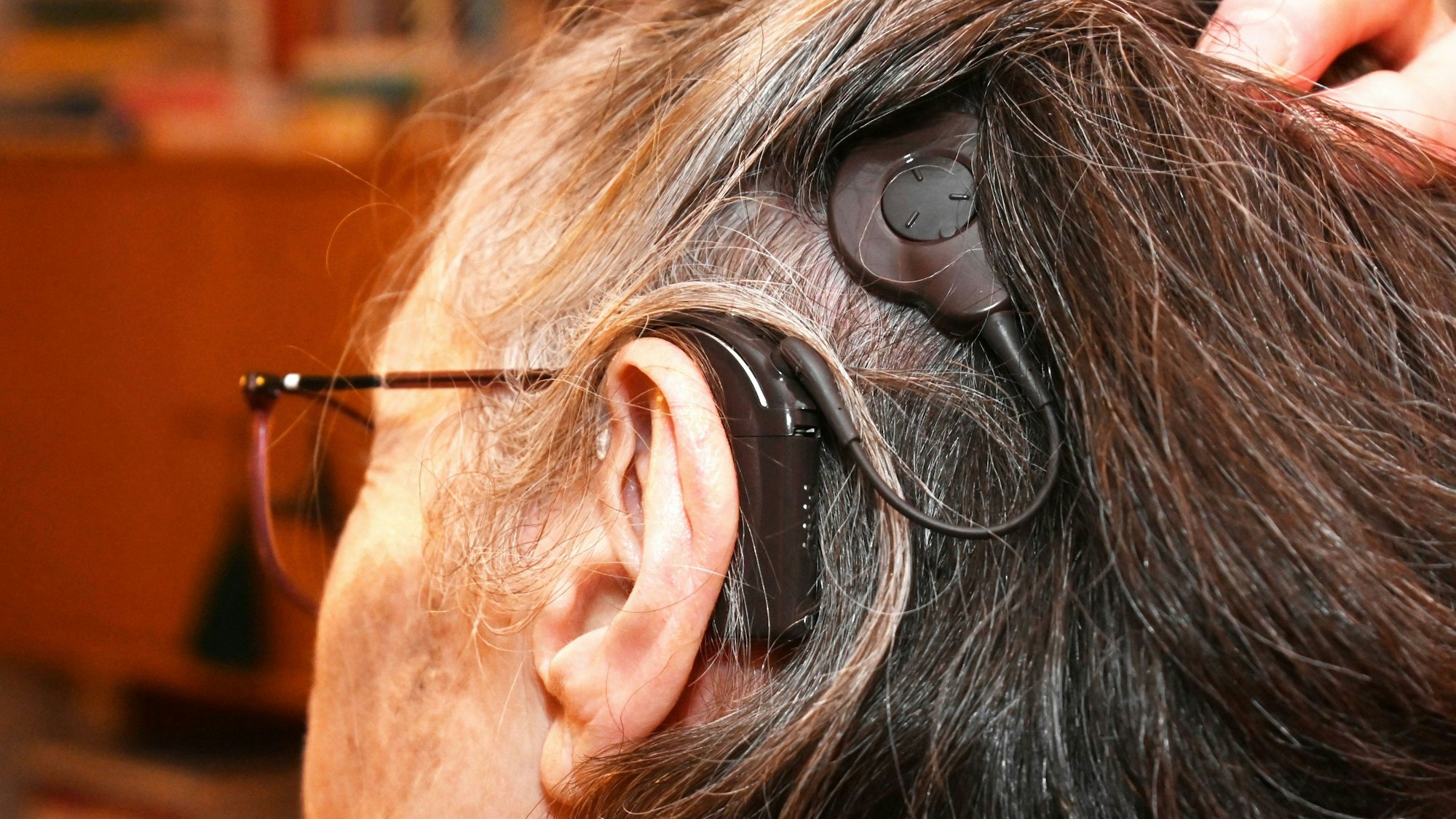 Vor 15 Jahren ließ sich Katharena S. ein Cochlea-Implantat einsetzen, eine Sonde, die direkt mit dem Hörnerv verbunden ist.