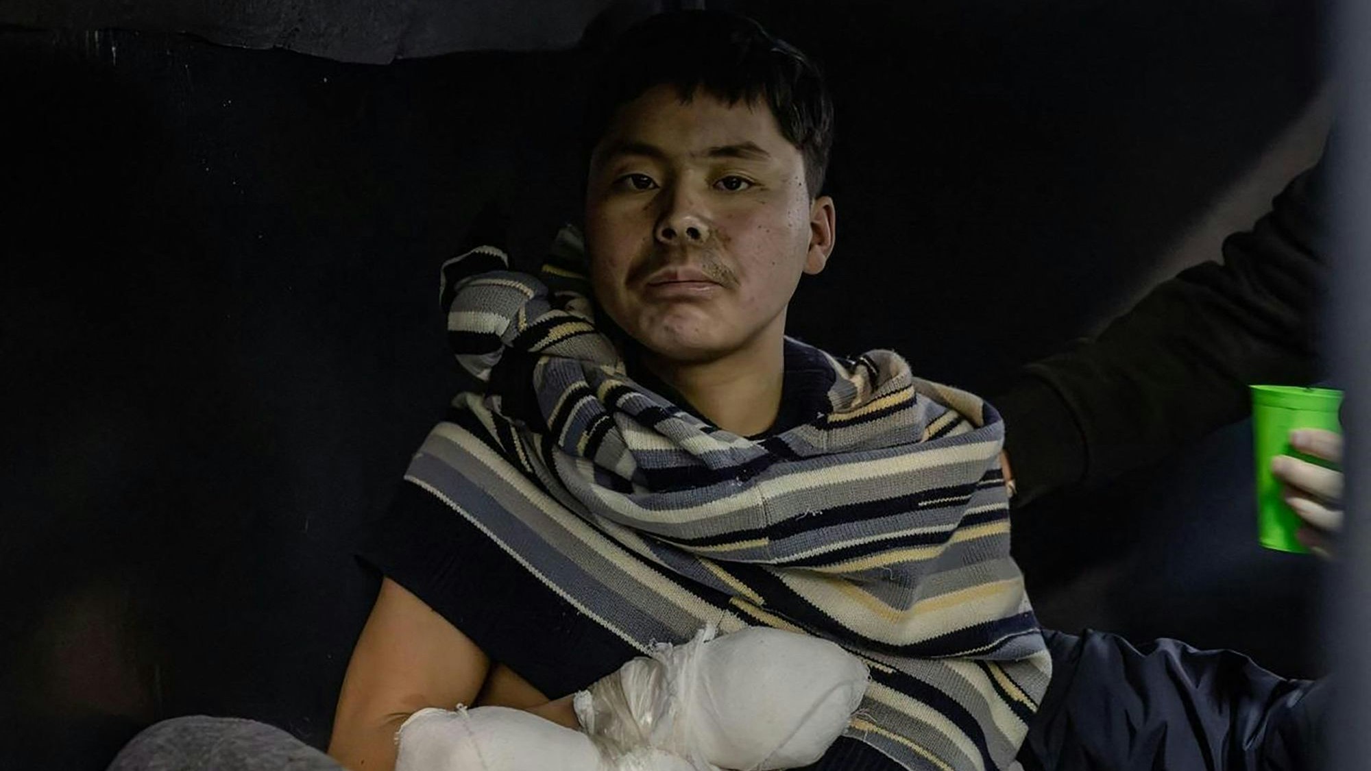 Der ukrainische Präsident Wolodymyr Selenskyj veröffentlichte ein Foto eines nordkoreanischen Gefangenen bei Telegram. Der Mann wurde im Gefecht offenbar schwer verletzt.