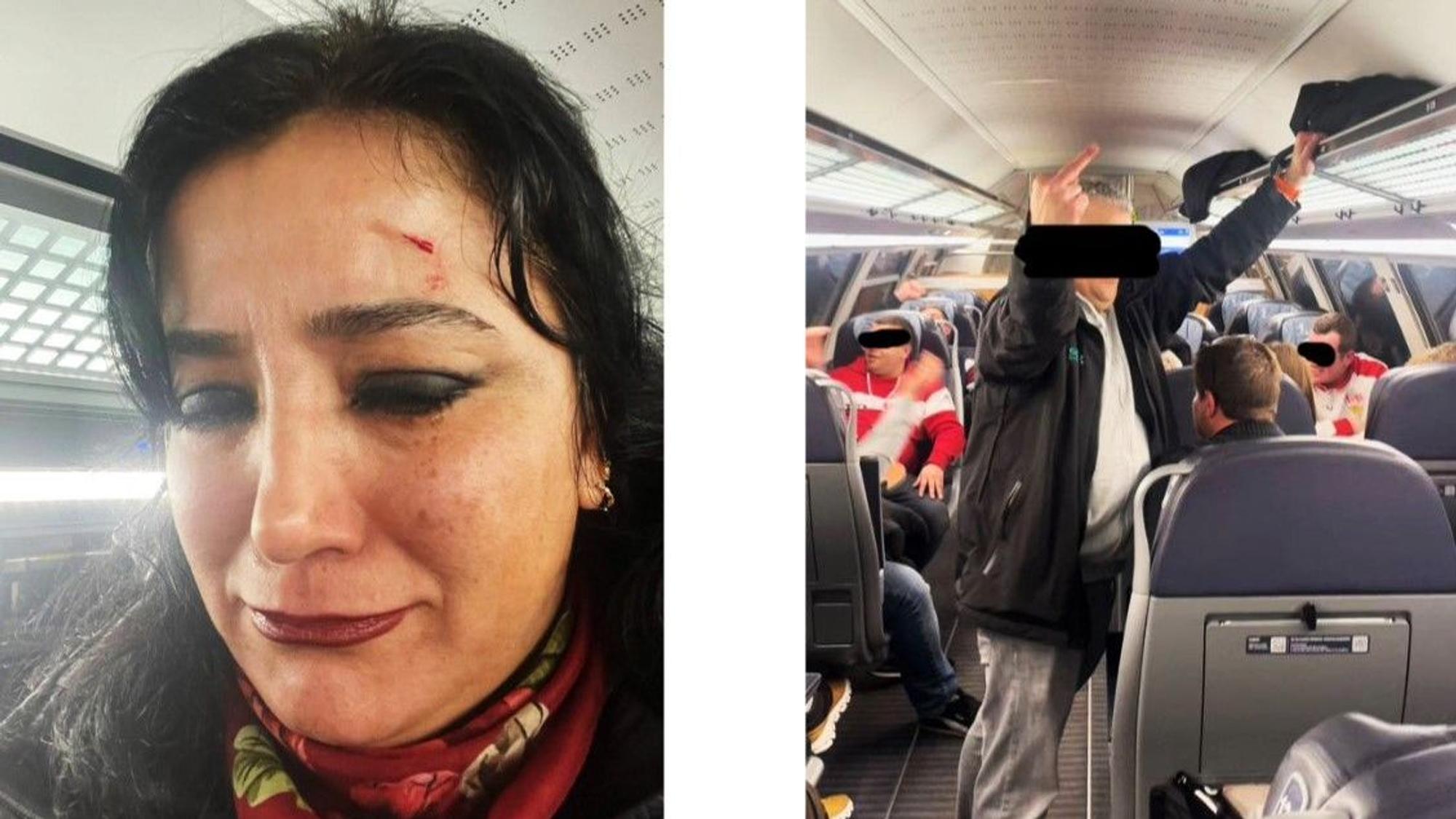 Diese Bilder hatte Gökay Akbulut, Linken-Politikerin, selbst veröffentlicht. Sie zeigen die Bundestagsabgeordnete mit einer Wunde am Kopf und einen Mann in einem Zug, der den Mittelfinger ausstreckt.