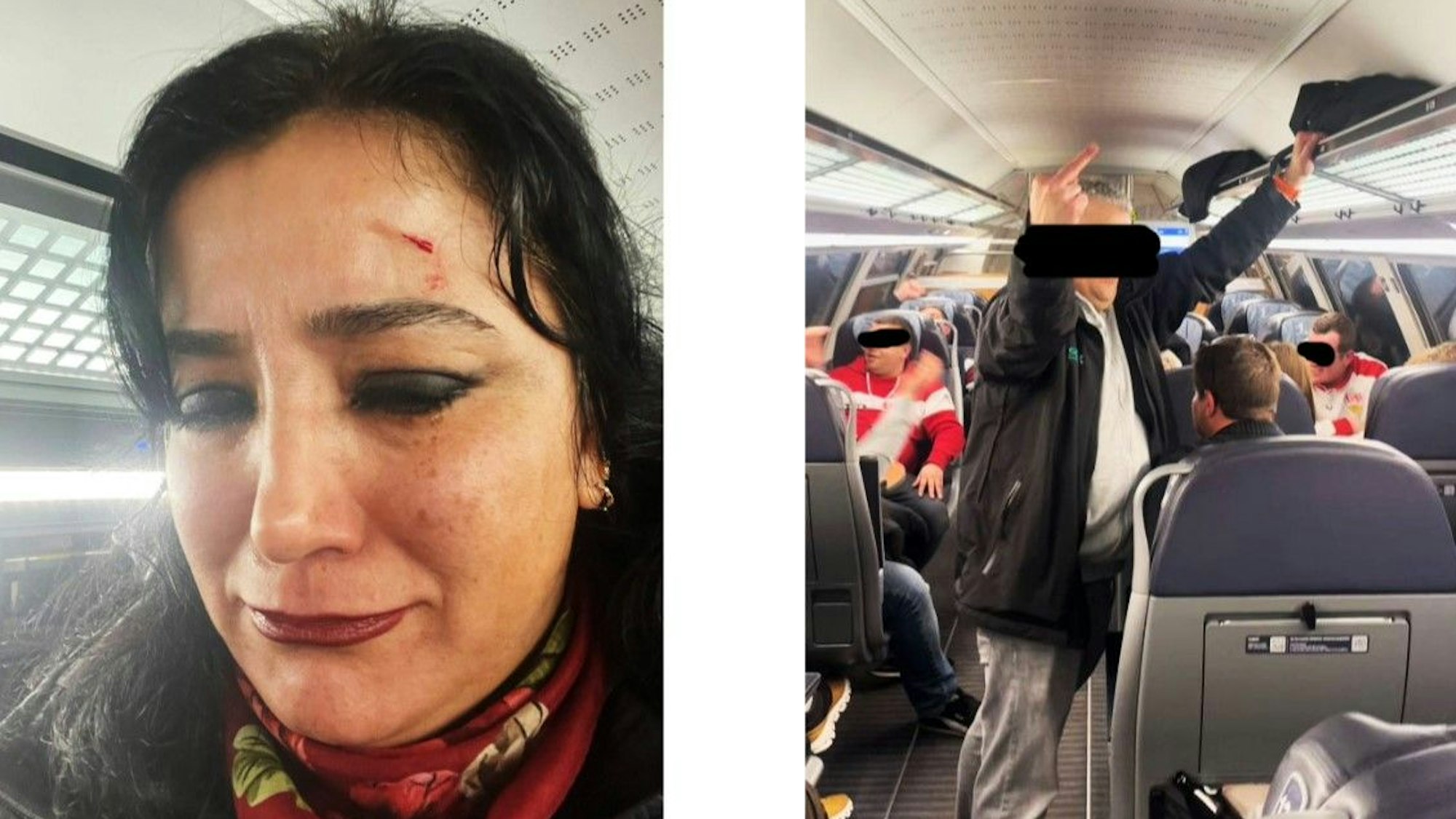 Gökay Akbulut postete im Anschluss Fotos auf ihrem Instagram-Kanal, die ihre Verletzung zeigen.