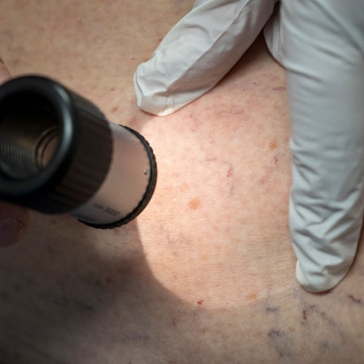 Bayern, München: Ein Arzt untersucht in der Praxis die Hautpartie eines Patienten.