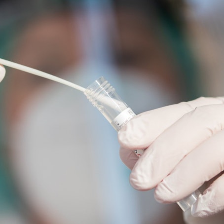 Ein Mitarbeiter eines Corona-Testzentrums zeigt einen Abstrich.