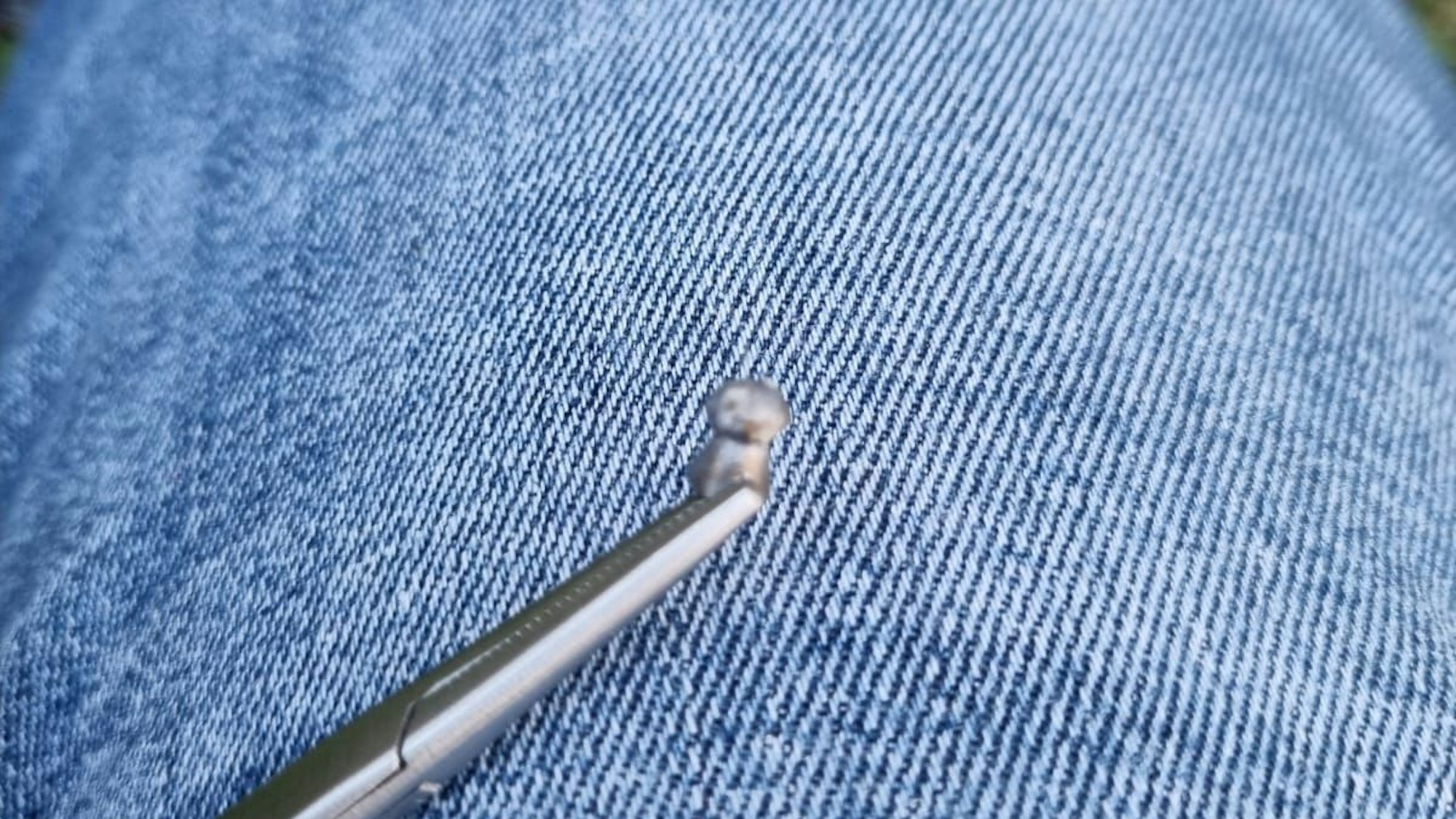 Die Kugel konnte noch vor Ort entfernt werden.