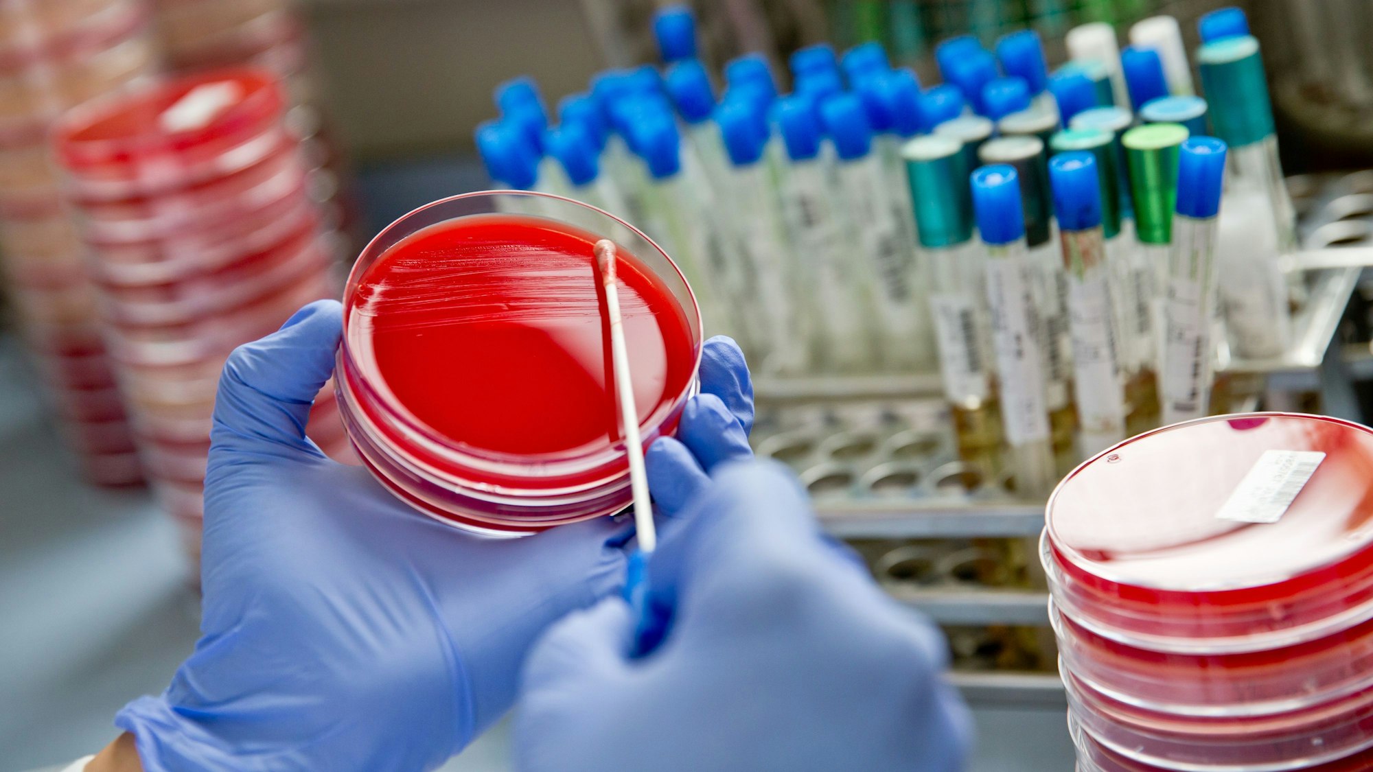 Eine Labormitarbeiterin verstreicht im Diagnostiklabor Untersuchungsmaterial mit einem Abstrichtupfer auf einer Bakterienkulturplatte.