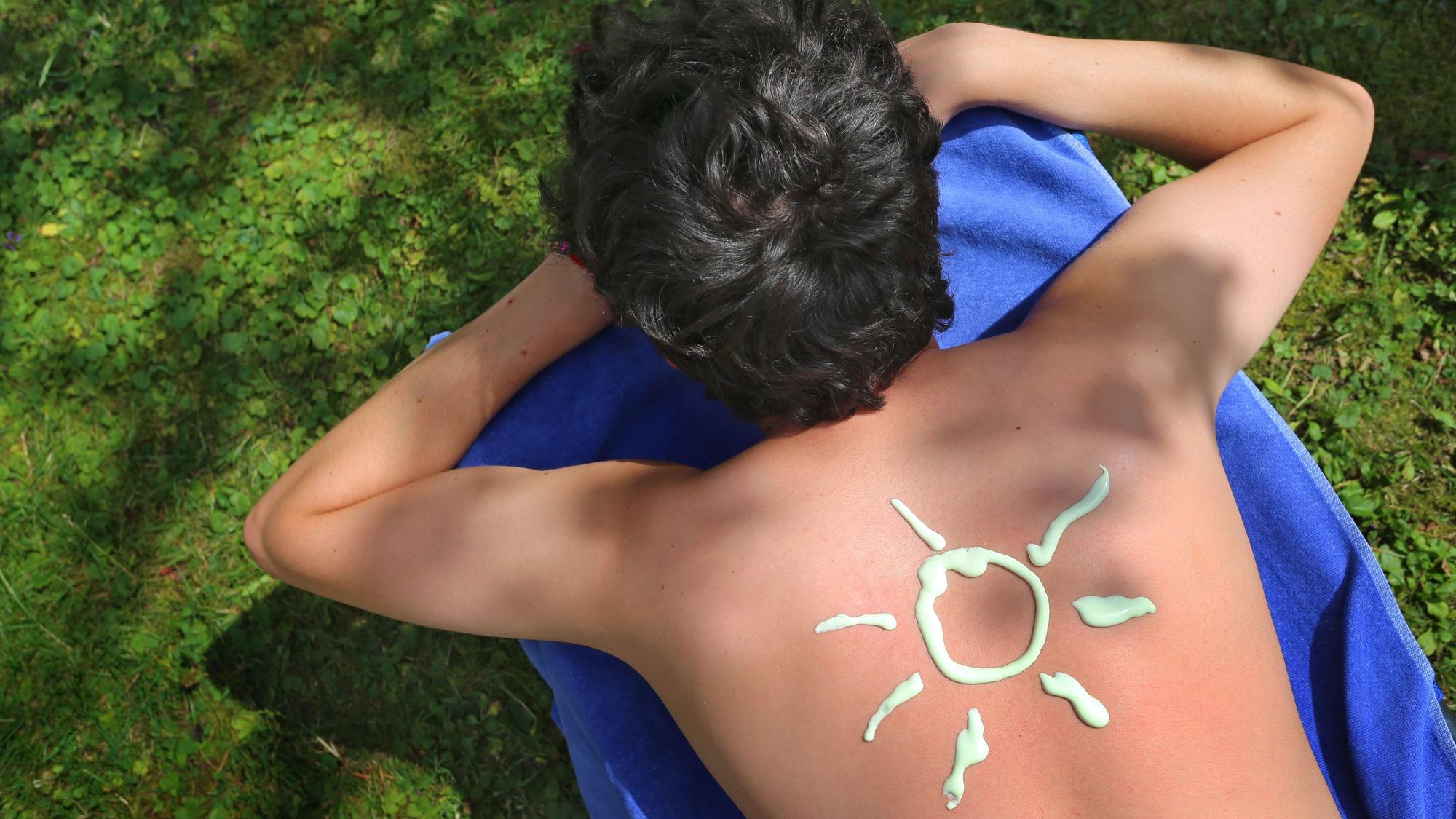 Eine Sonnencreme-Sonne ist auf einem Rücken zu sehen. (Archivbild)