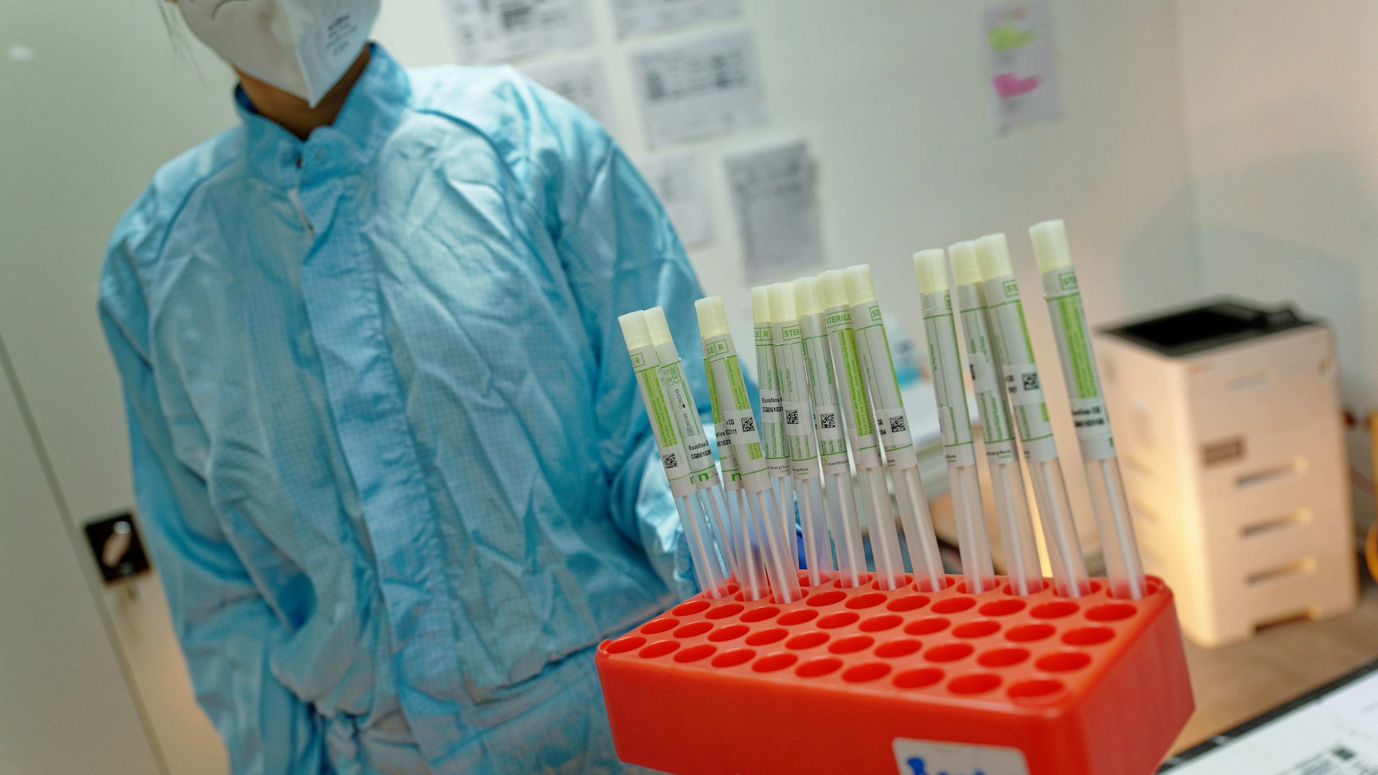 Teststäbchen stehen im Labor zur Auswertung (Symbolfoto).