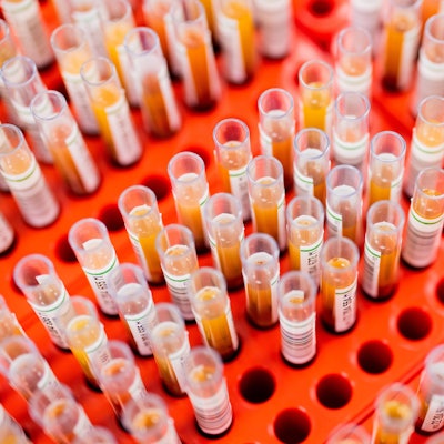 Die Kontaktpersonen müssen sich einer Blutuntersuchung unterziehen (Symbolfoto).