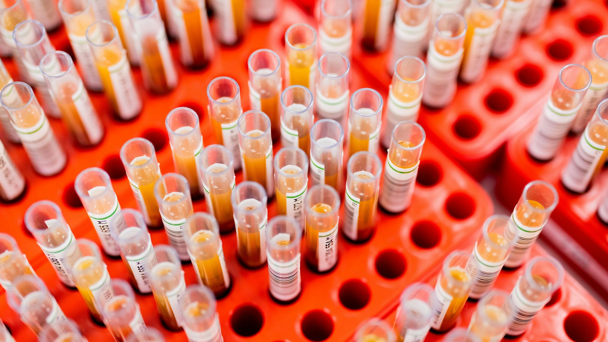 Die Kontaktpersonen müssen sich einer Blutuntersuchung unterziehen (Symbolfoto).