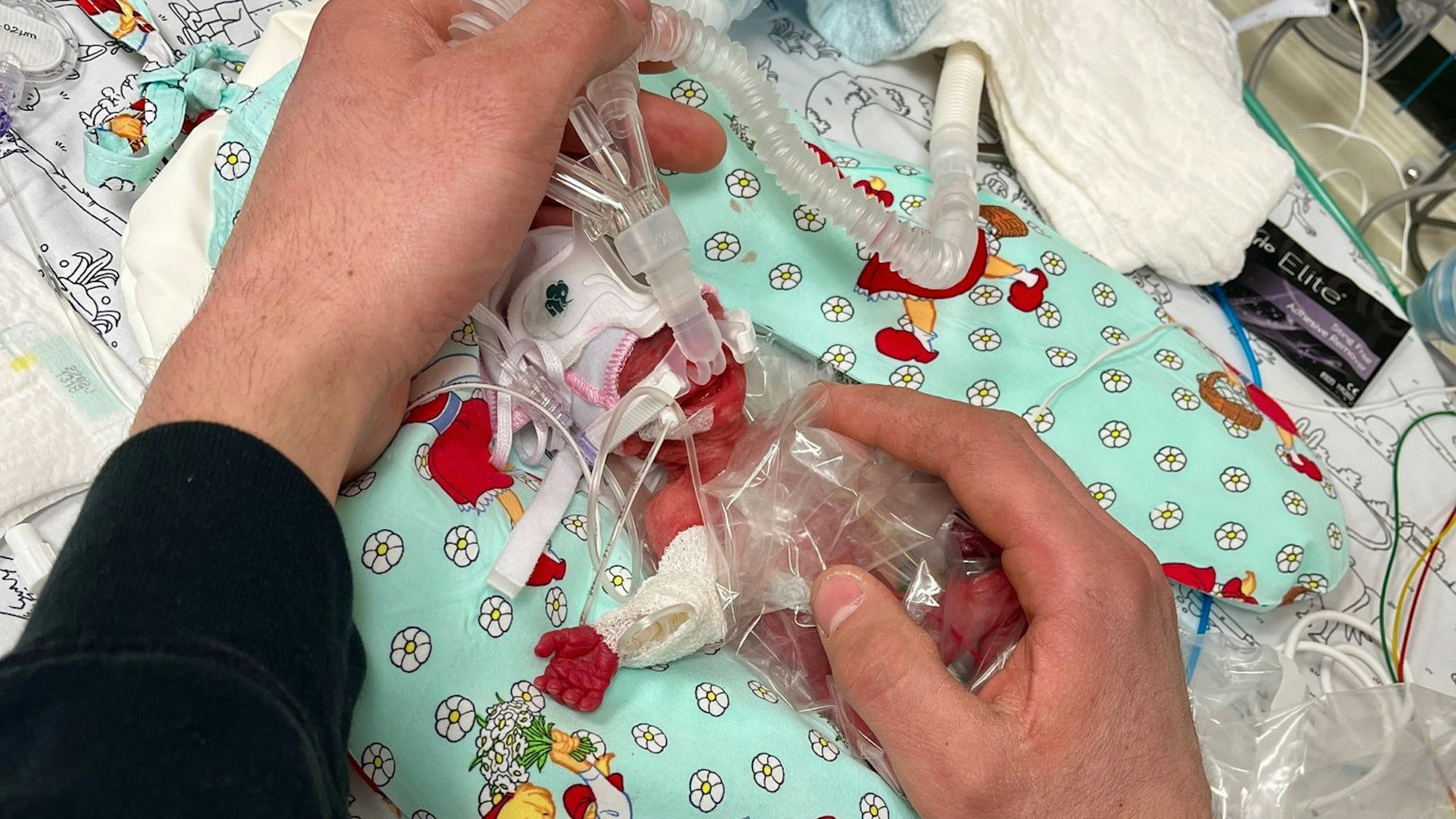 Etwas mehr als ein Päckchen Butter wog die kleine Marie, als sie im Februar zur Welt kam. Seitdem ist das Kind gut gewachsen.