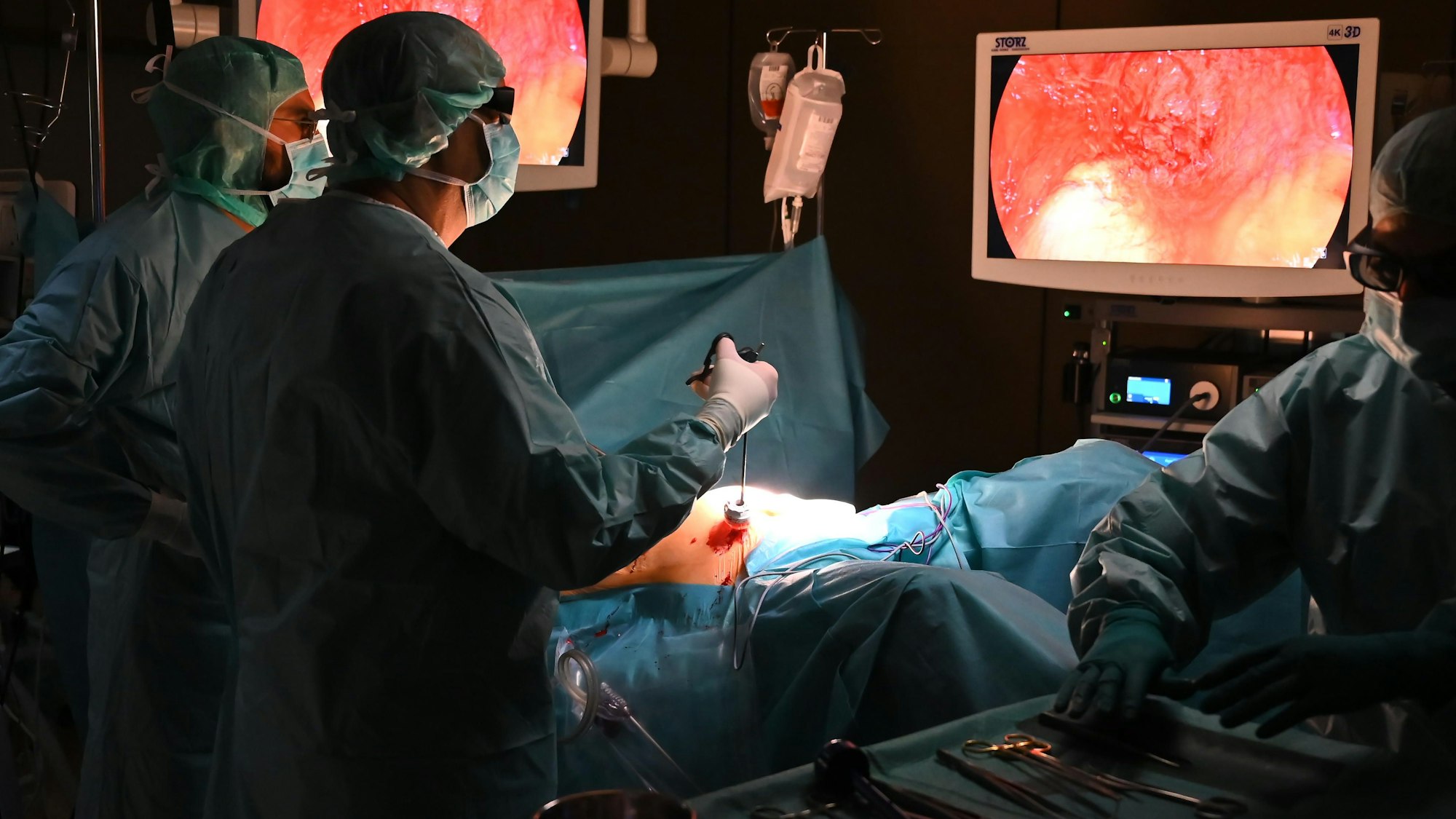 Szene aus einer OP von Professor Stefan Saad.