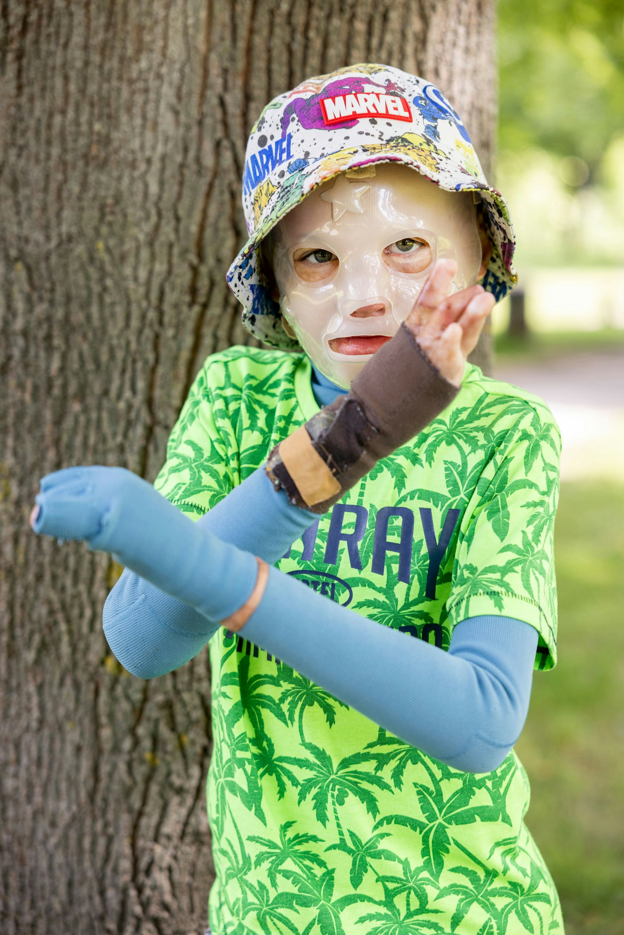 14.05.2025, Köln: Yurii und Yevhen aus der Ukraine wurden durch eine Explosion einer Erdölraffinerie schwerst verbrannt und in der Uniklinik Köln behandelt.
Aufnahmen bei einem Ausflug in einen Park zusammen mit ihrer Familie, der in der Nähe ihrer Unterkunft liegt.
Im Bild Yurii (grüngemustertes T-Shirt).
Foto: Michael Bause