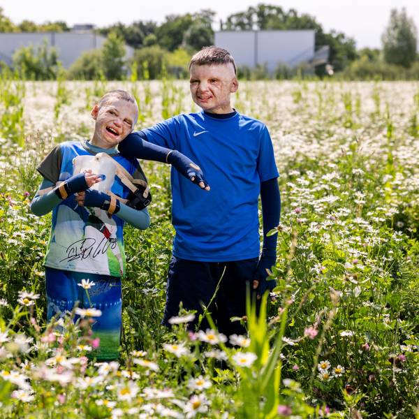 14.05.2025, Köln: Yurii und Yevhen aus der Ukraine wurden durch eine Explosion einer Erdölraffinerie in der Ukraine schwerst verbrannt und in der Uniklinik Köln behandelt.
Im Bild v.l.n.r. Yurii und Yevhen.
Foto: Michael Bause