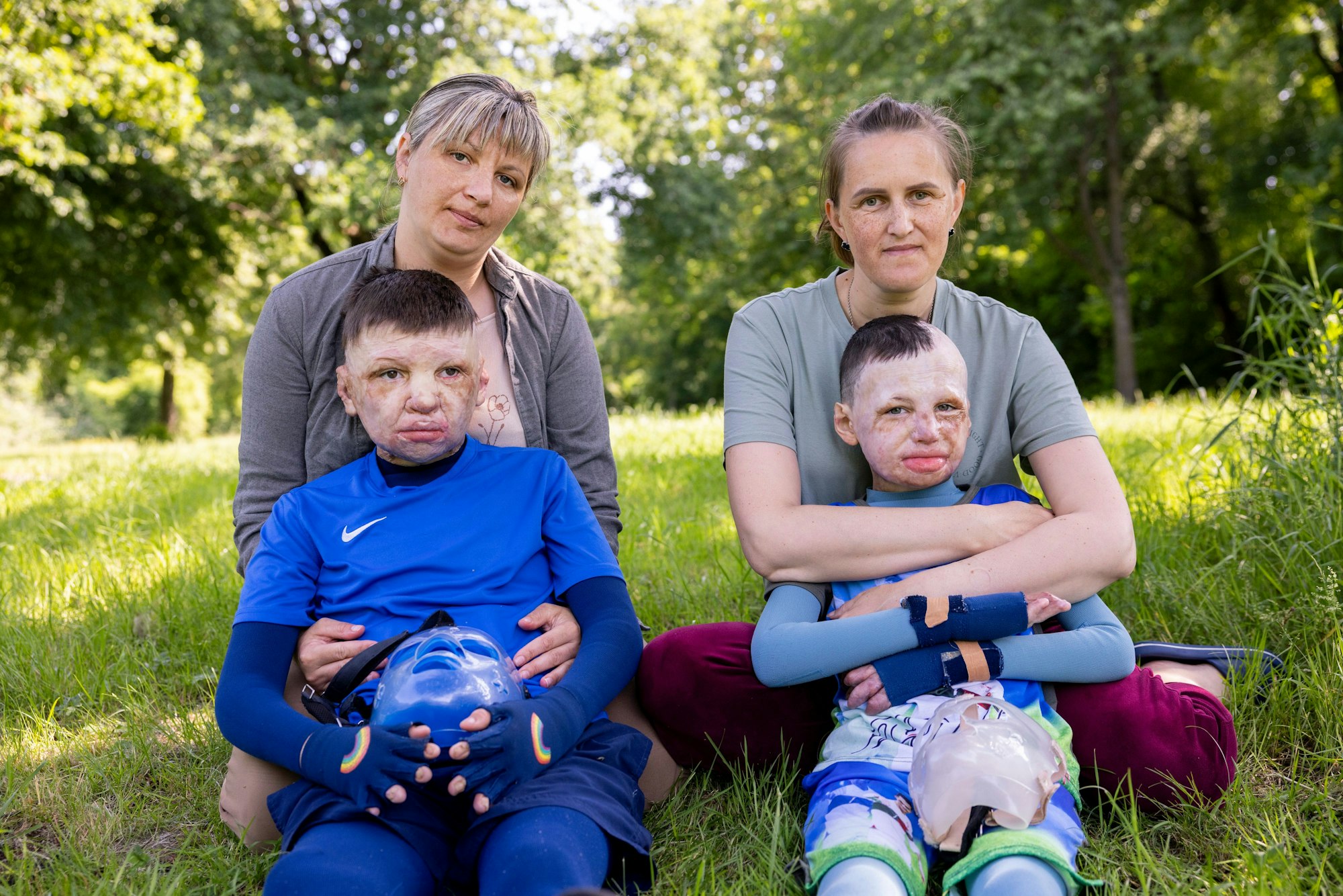 14.05.2025, Köln: Yurii und Yevhen aus der Ukraine wurden durch eine Explosion einer Erdölraffinerie in der Ukraine schwerst verbrannt und in der Uniklinik Köln behandelt.
Im Bild v.l.n.r. Yevhen und Yurii mit ihren Müttern.
Foto: Michael Bause