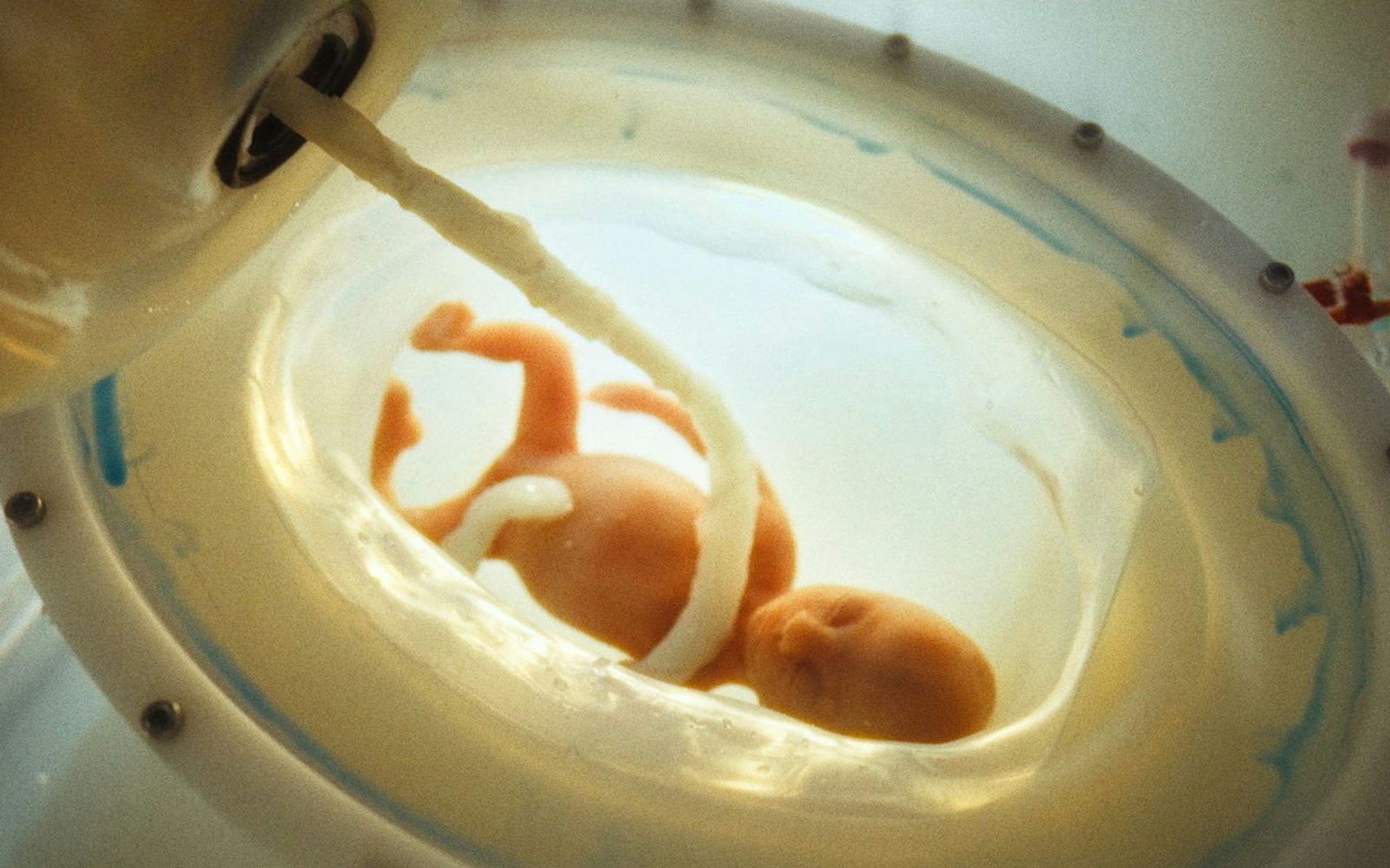 Noch ist ein künstlicher Uterus, in dem ein Menschenbaby heranwächst, Zukunftsmusik. Doch erste Experimente in diese Richtung reichen schon jetzt erstaunlich weit, wie die dreiteilige Doku „Sex and the Scientists - Wie wir künftig Kinder bekommen“ zeigt. (Bild: BR)