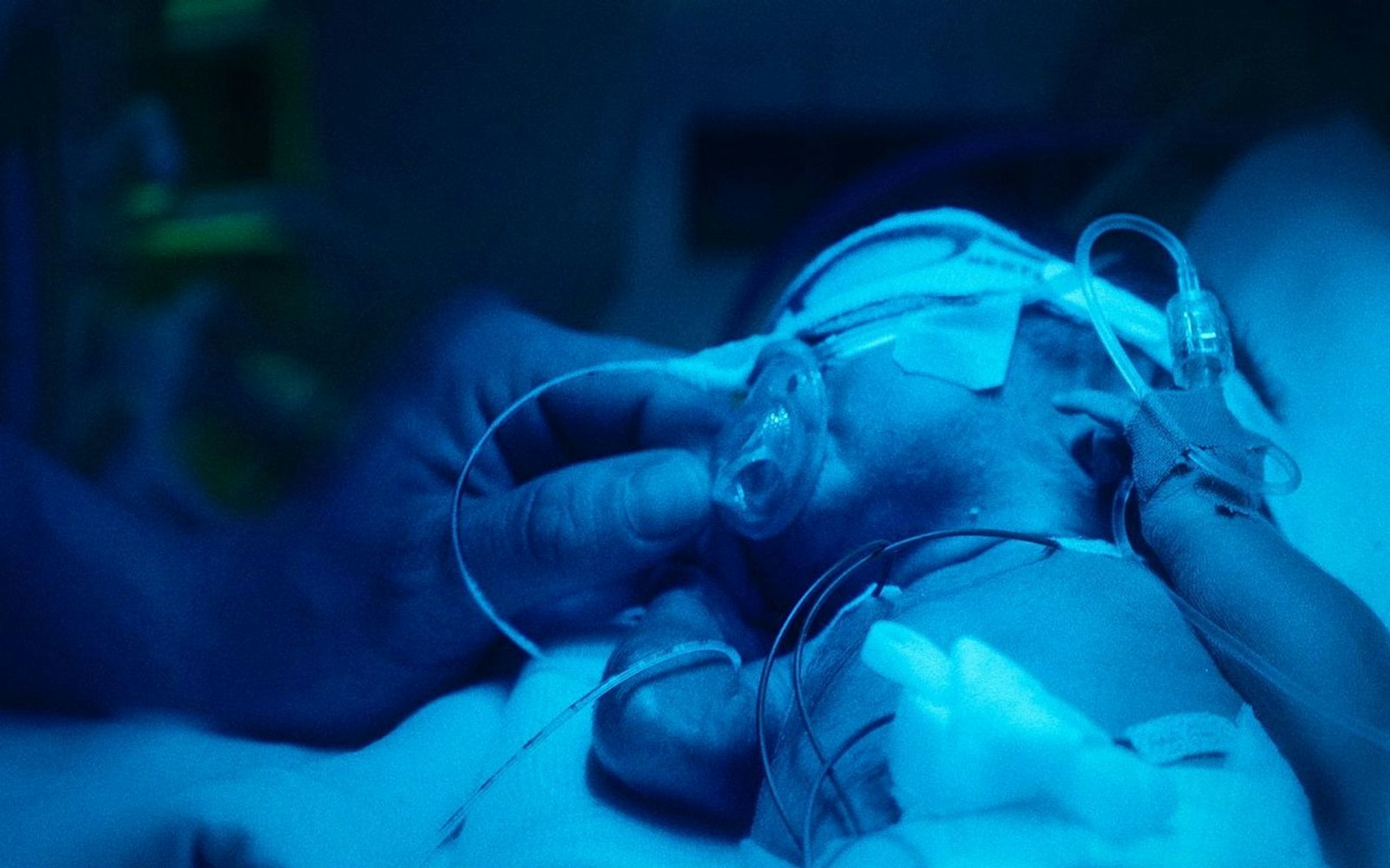 Ein künstlicher Uterus könnte in Zukunft nicht nur Babys außerhalb des menschlichen Körpers heranreifen lassen. Er könnte ebenso Frühchen retten. (Bild: BR)