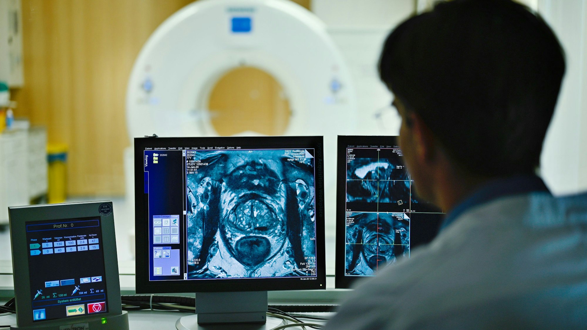 ARCHIV - 16.01.2020, Baden-Württemberg, Heidelberg: Ein Mitarbeiter betrachtet in einem Kontrollraum des Deutschen Krebsforschungszentrum (DKFZ) auf einem Monitor das Querschnittsbild einer Prostata. Bei einem Presse-Workshop zum Weltkrebstag (4. Februar) wurden am DKFZ neueste Entwicklungen bei bildgebenden Verfahren in Diagnose und Therapie von Krebs vorgestellt. (Zu dpa "EU will Krebs den Kampf ansagen") Foto: Uwe Anspach/dpa +++ dpa-Bildfunk +++