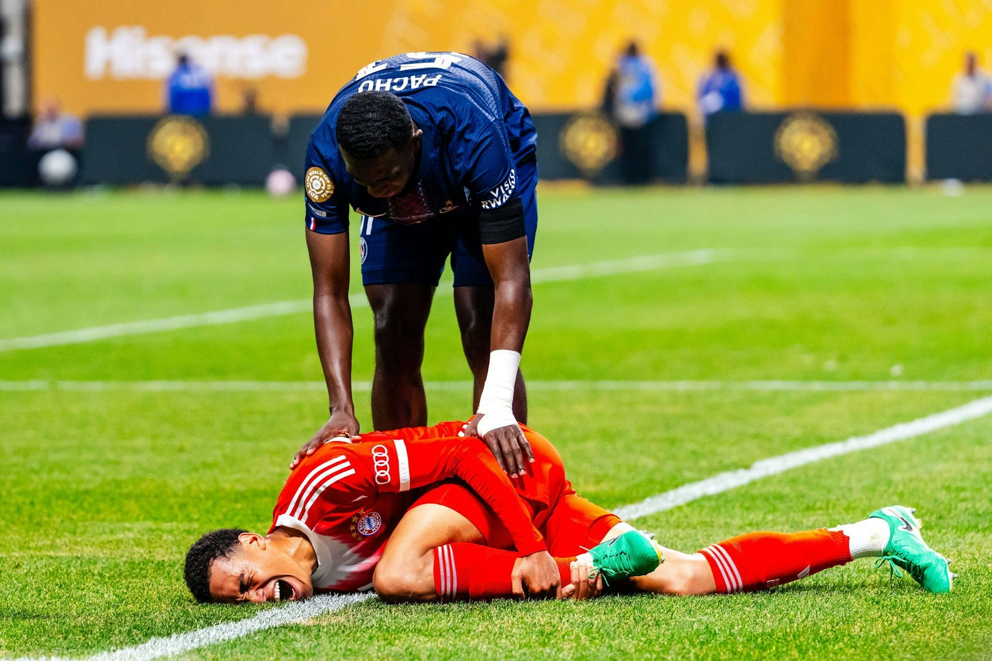 Fußball-Nationalspieler Jamal Musiala fällt wegen eines Wadenbeinbruchs lange aus.