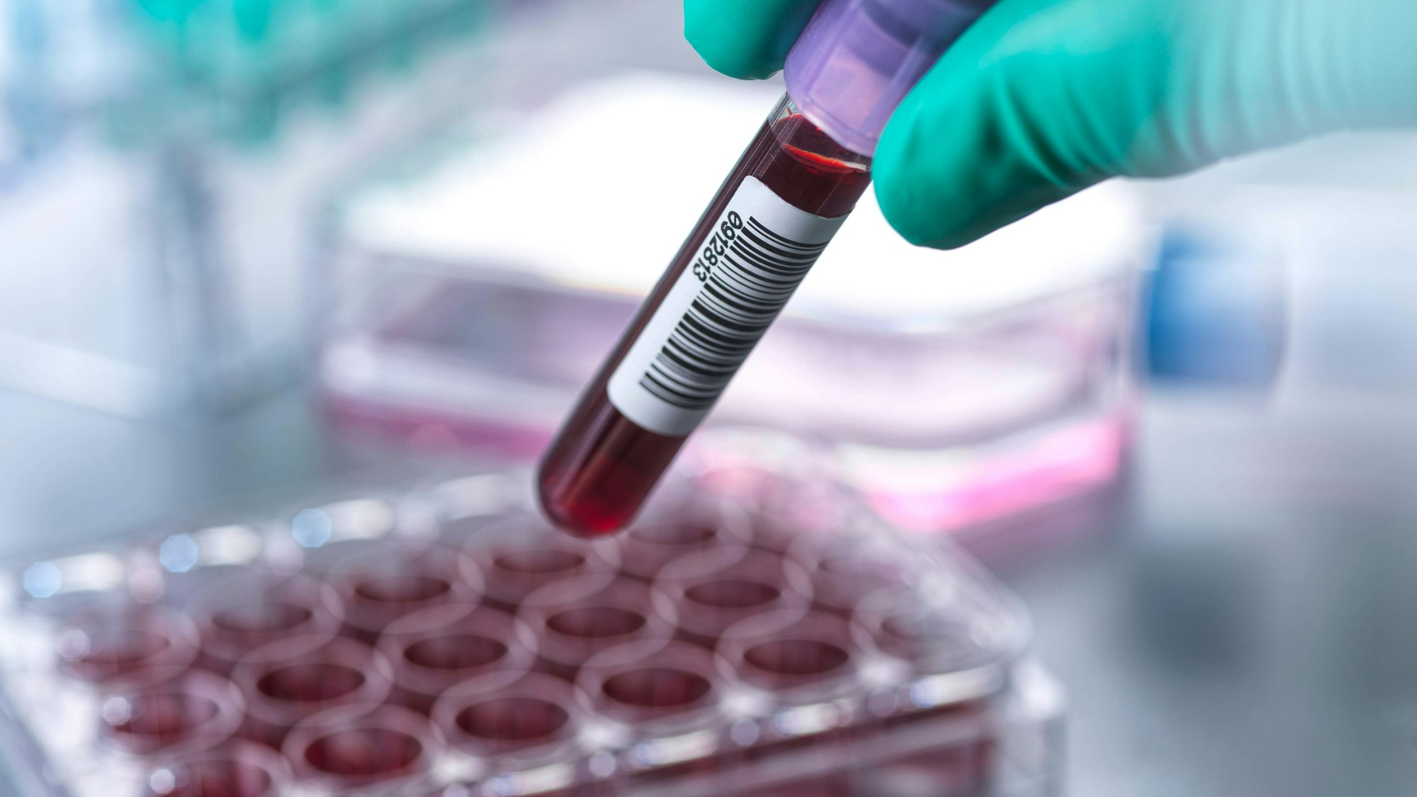 Scientist holding blood collection tube at laboratory model released, Symbolfoto property released, ABRF01184