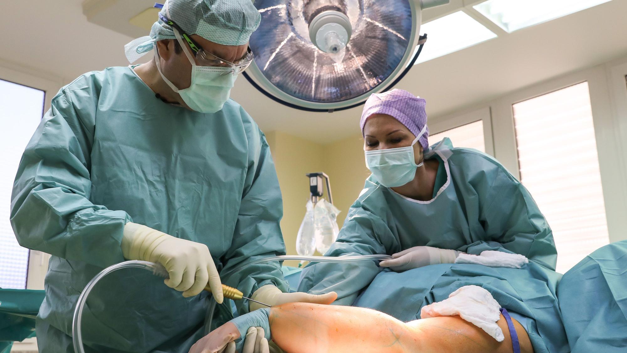 Schönheitschirurg Dr. Slobodan Reba operiert eine Patientin mit Lipödem an den Armen. Bei der OP am rechten Arm hat der Dr. bereits über 6Kg aus dem Arm gesaugt.